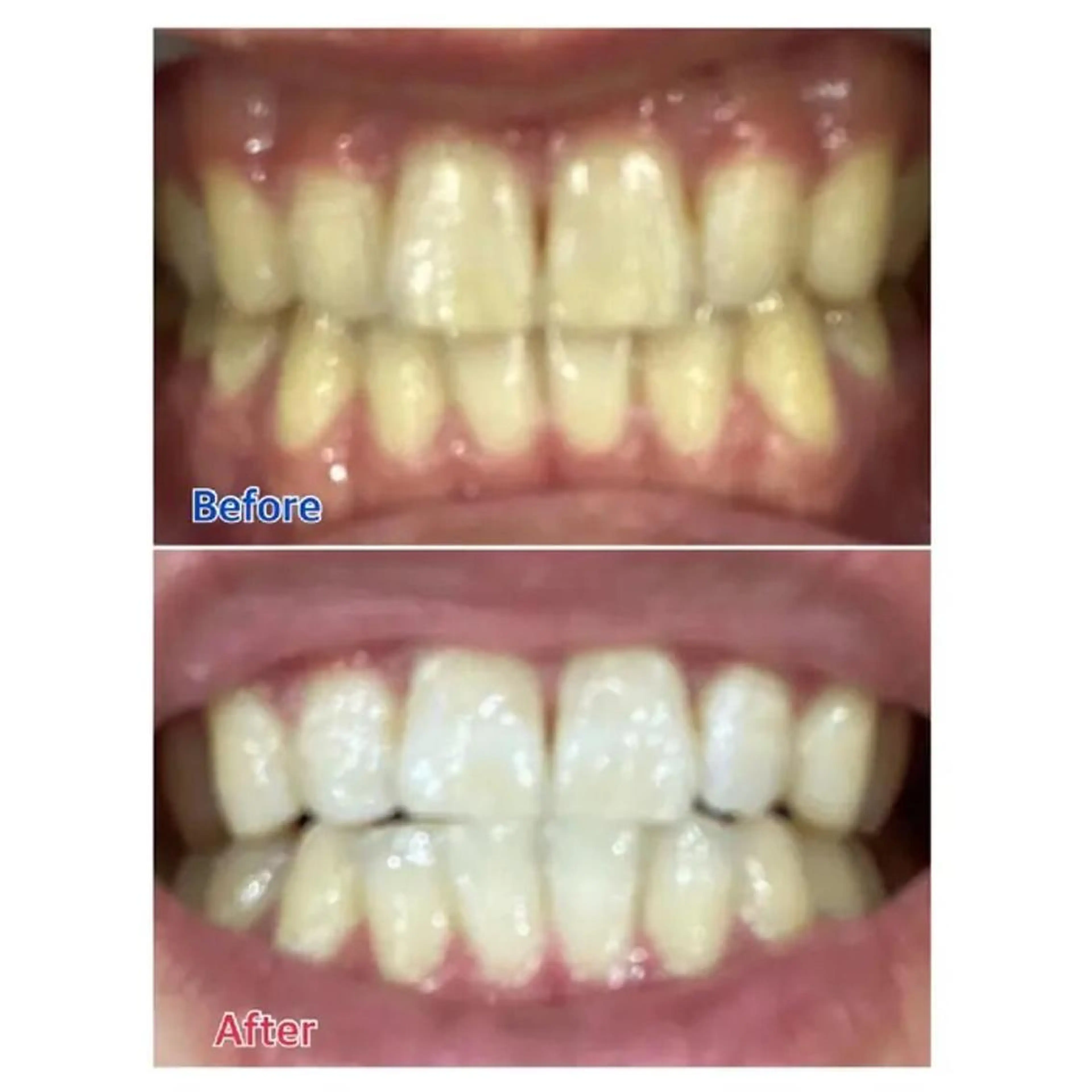 Ｍ渋谷 ホワイトニングのエステ・リラクイメージ