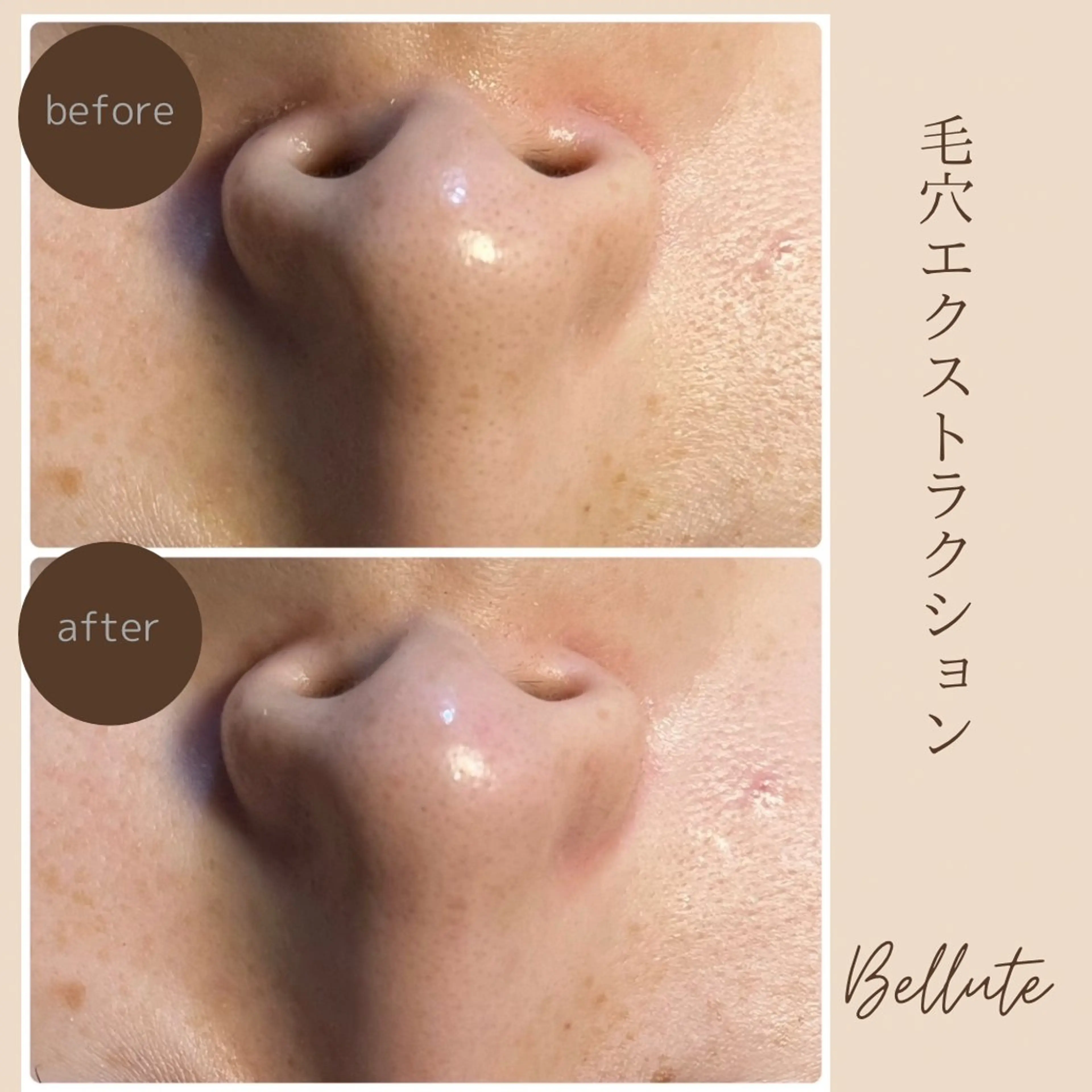 ピーリング専門店 Belluteのエステ・リラクイメージ