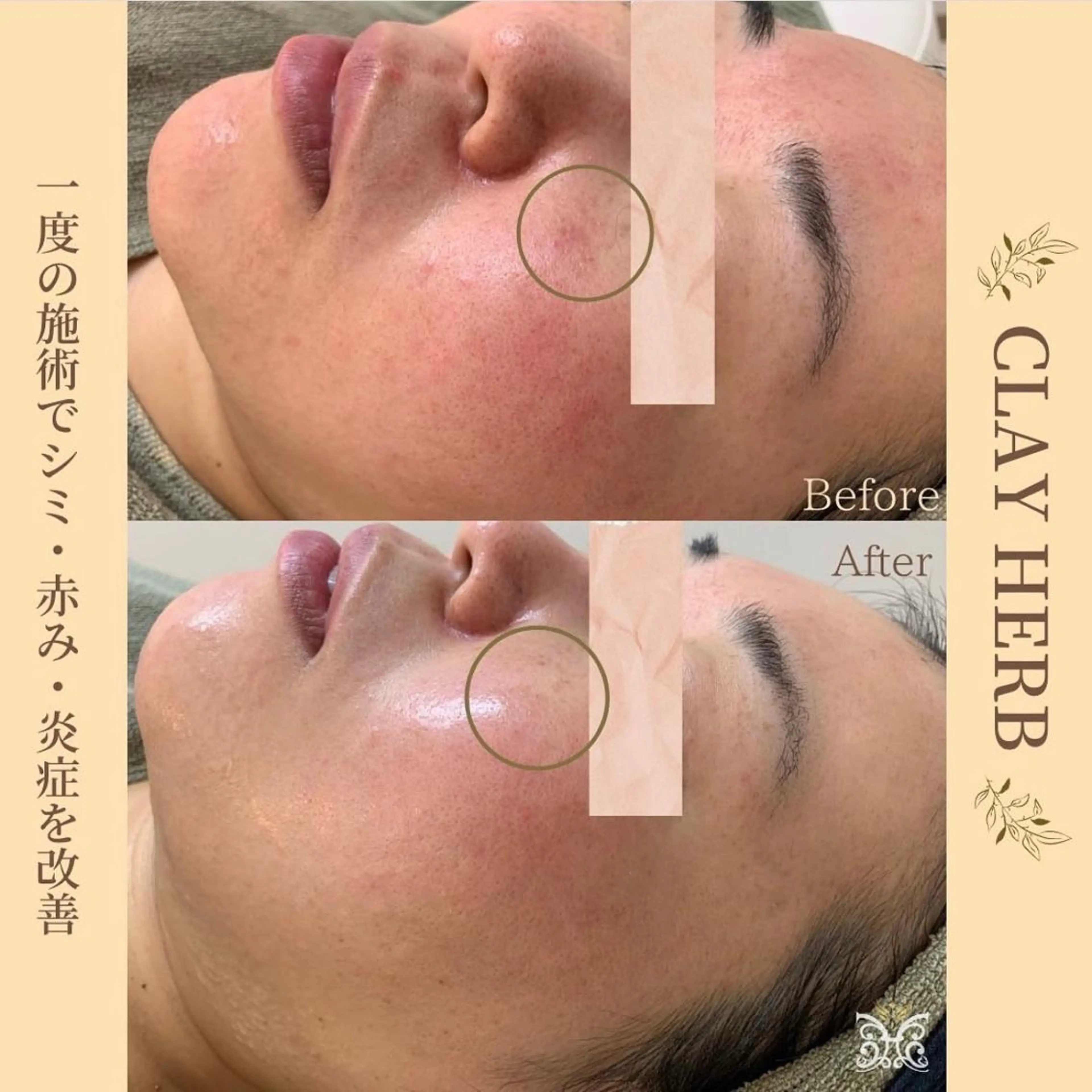 エステ デトックス専門サロン ココシュエットのエステ・リラクイメージ