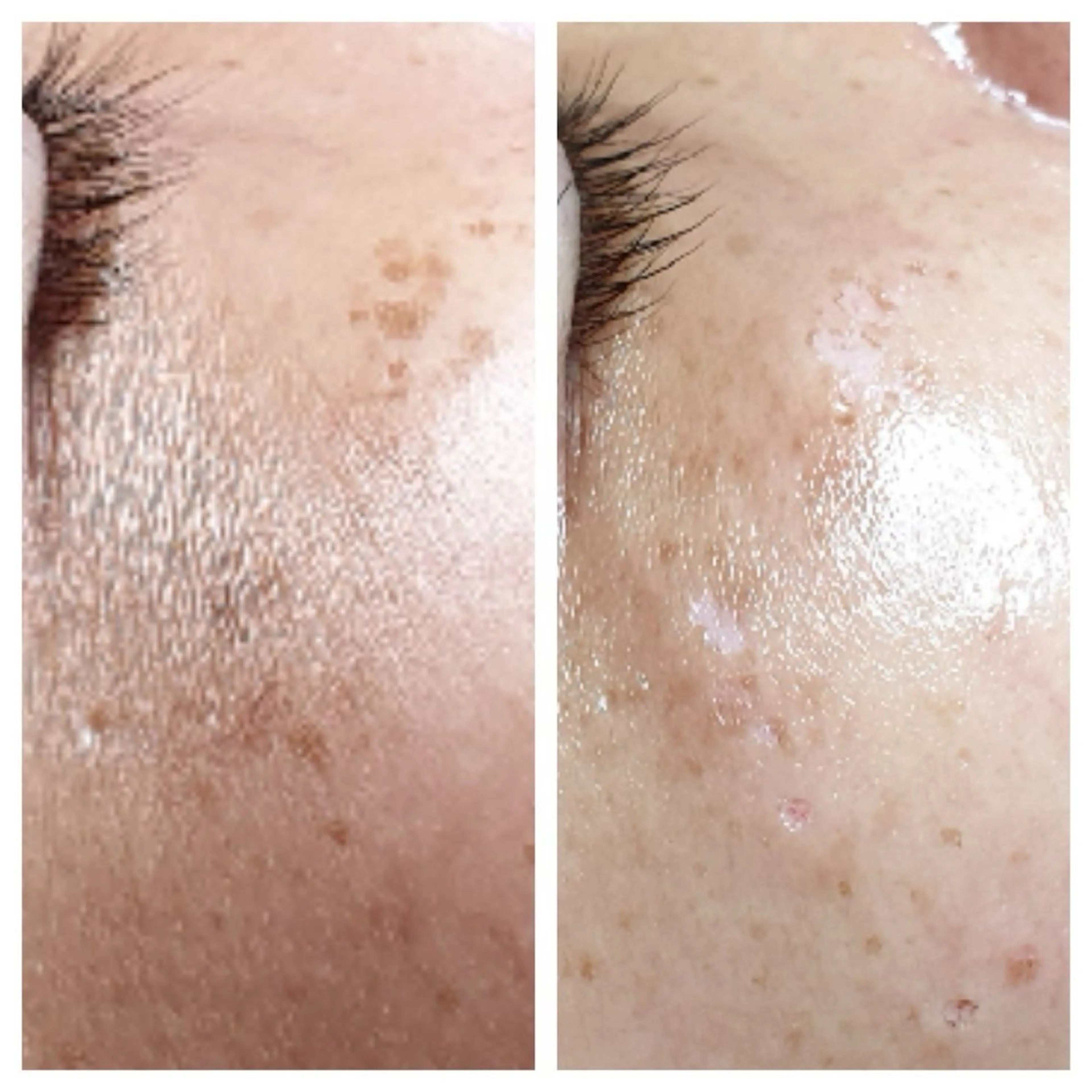 エステ 看護師が施術する美容 ナスサロ/matsuのエステ・リラクイメージ