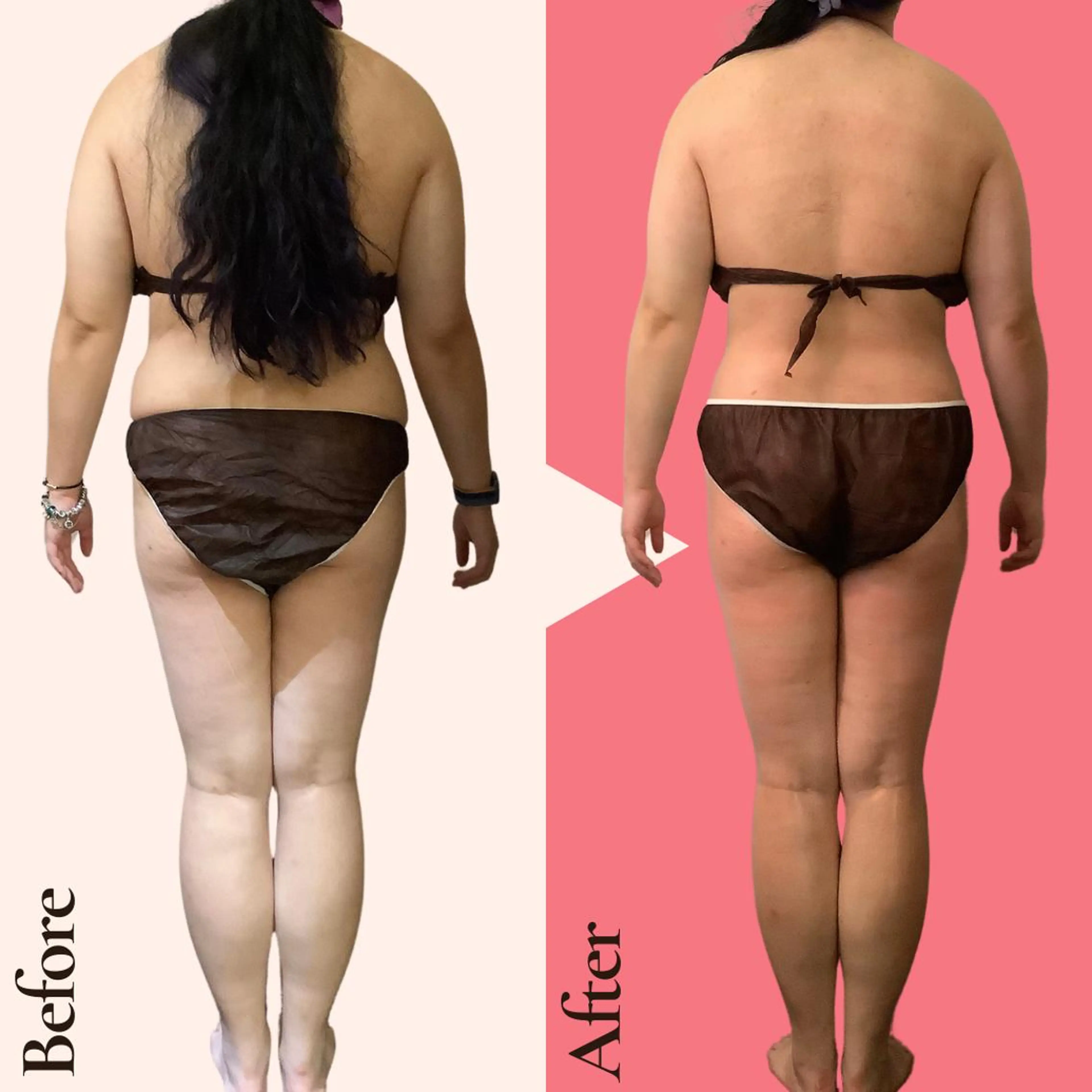 エステ リラク 痩身ダイエット専門店 プレシャスのエステ・リラクイメージ