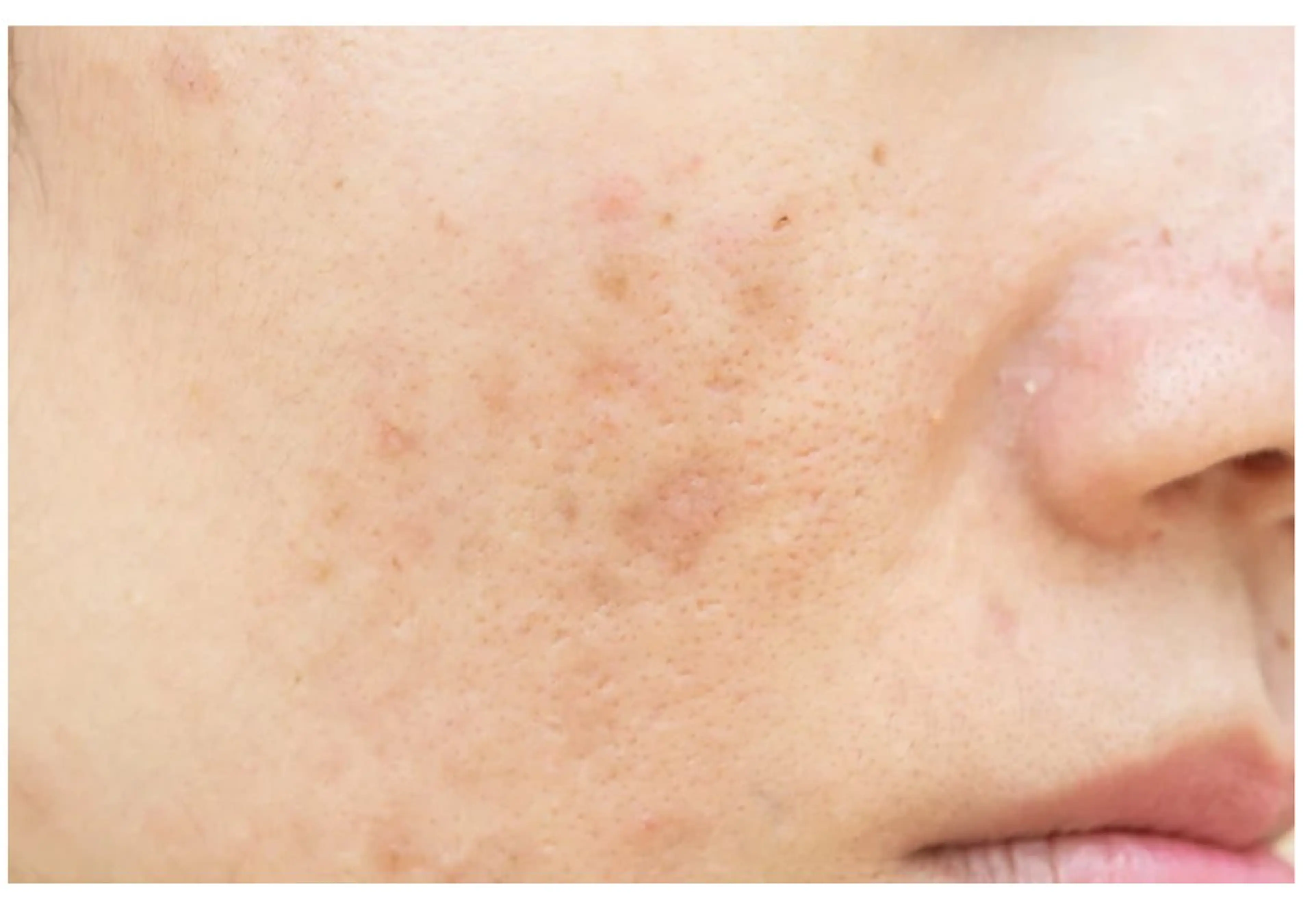 Empreinte (アンプラント)のエステ・リラクイメージ