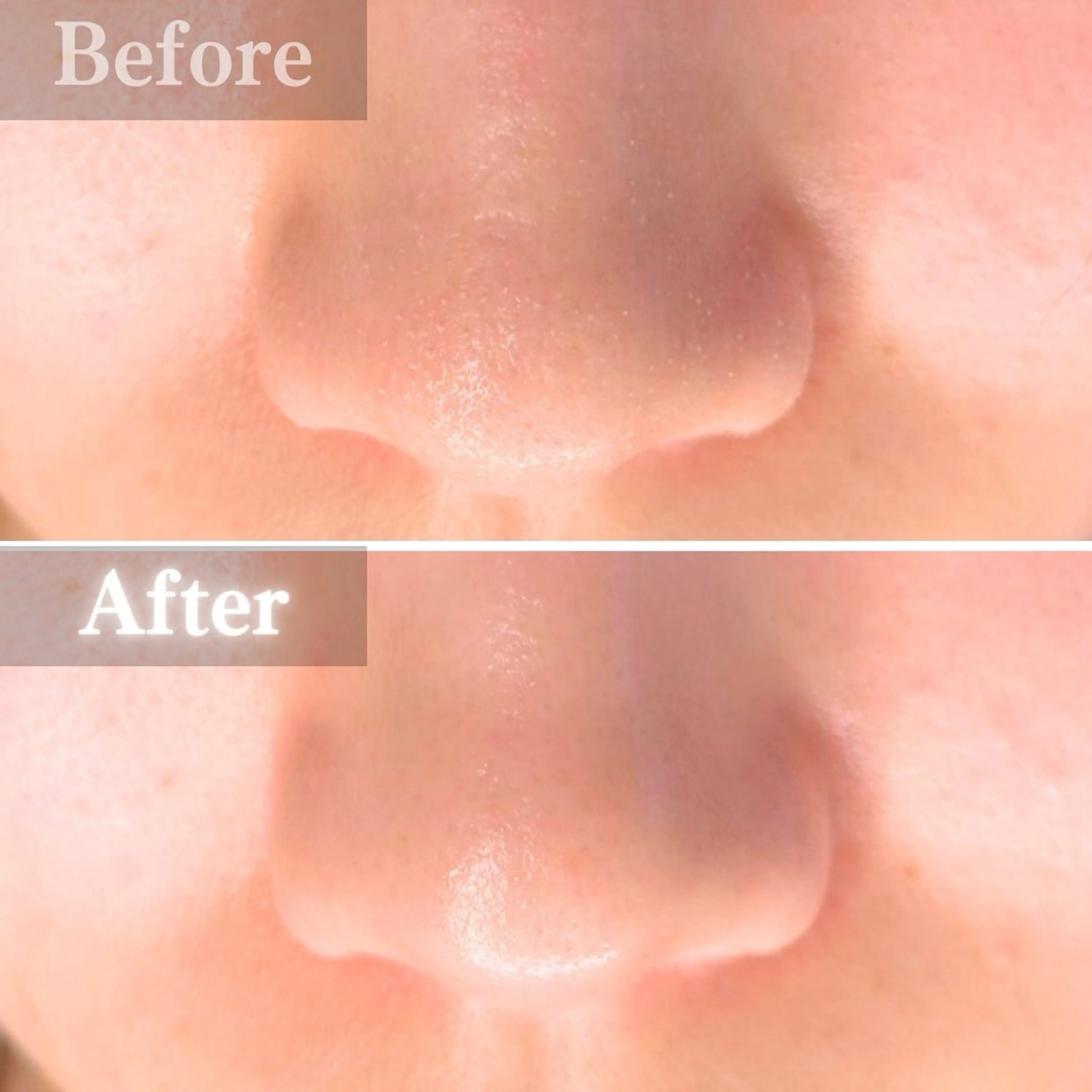 エステ 毛穴洗浄特化🫧 オオツカのエステ・リラクイメージ