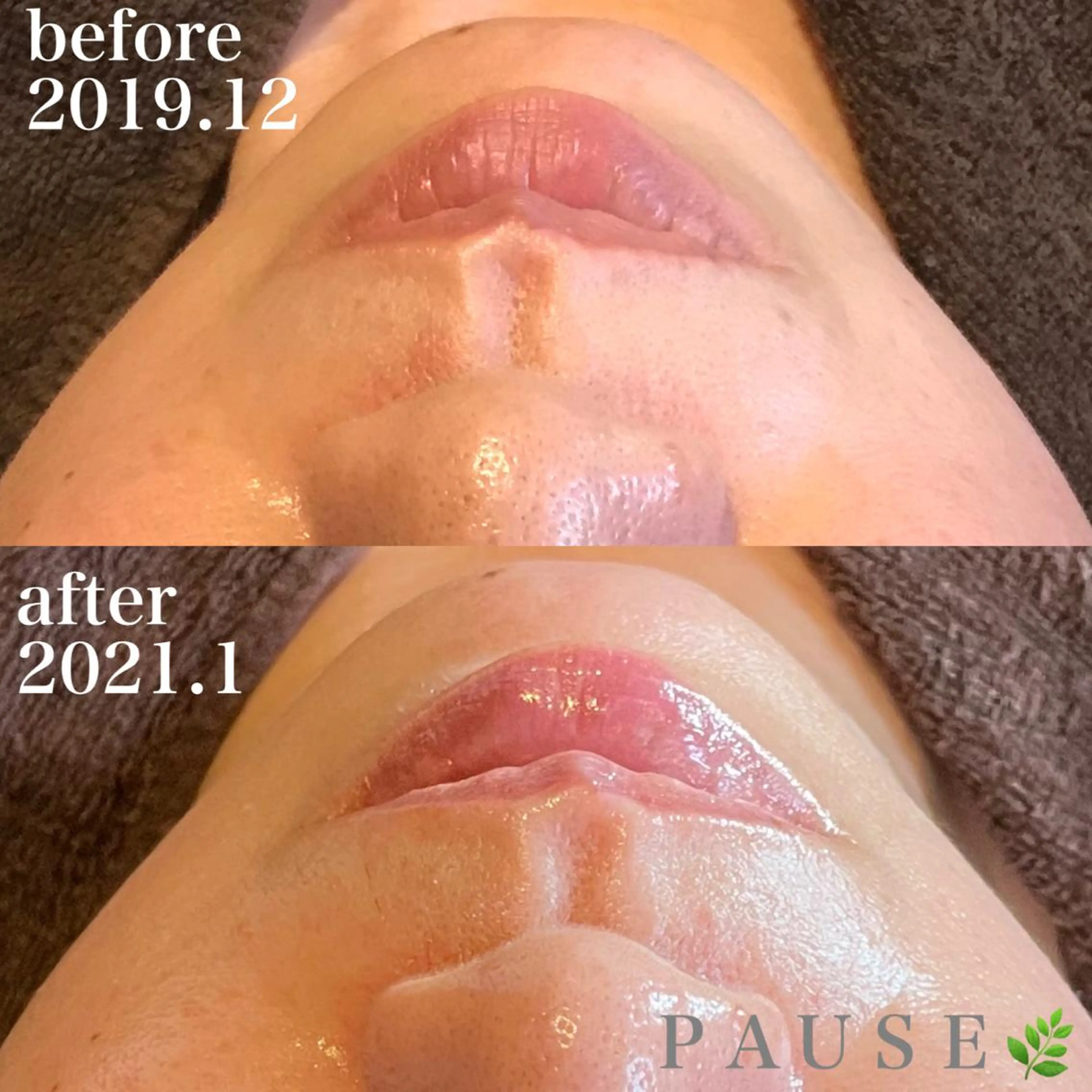 エステ 浜野 恵美のエステ・リラクイメージ