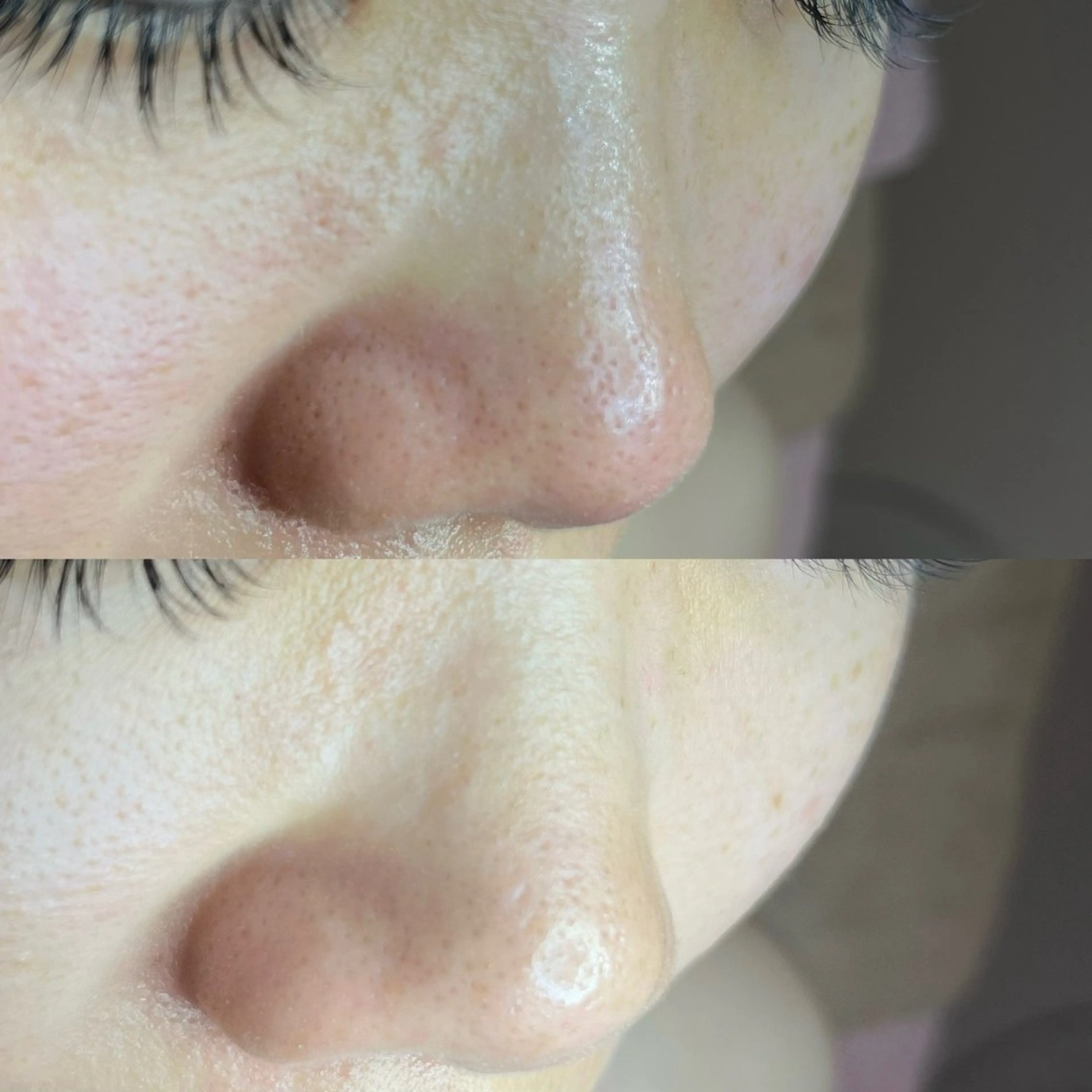 毛穴ケア・ヘッドスパ サロンSHINYのエステ・リラクイメージ