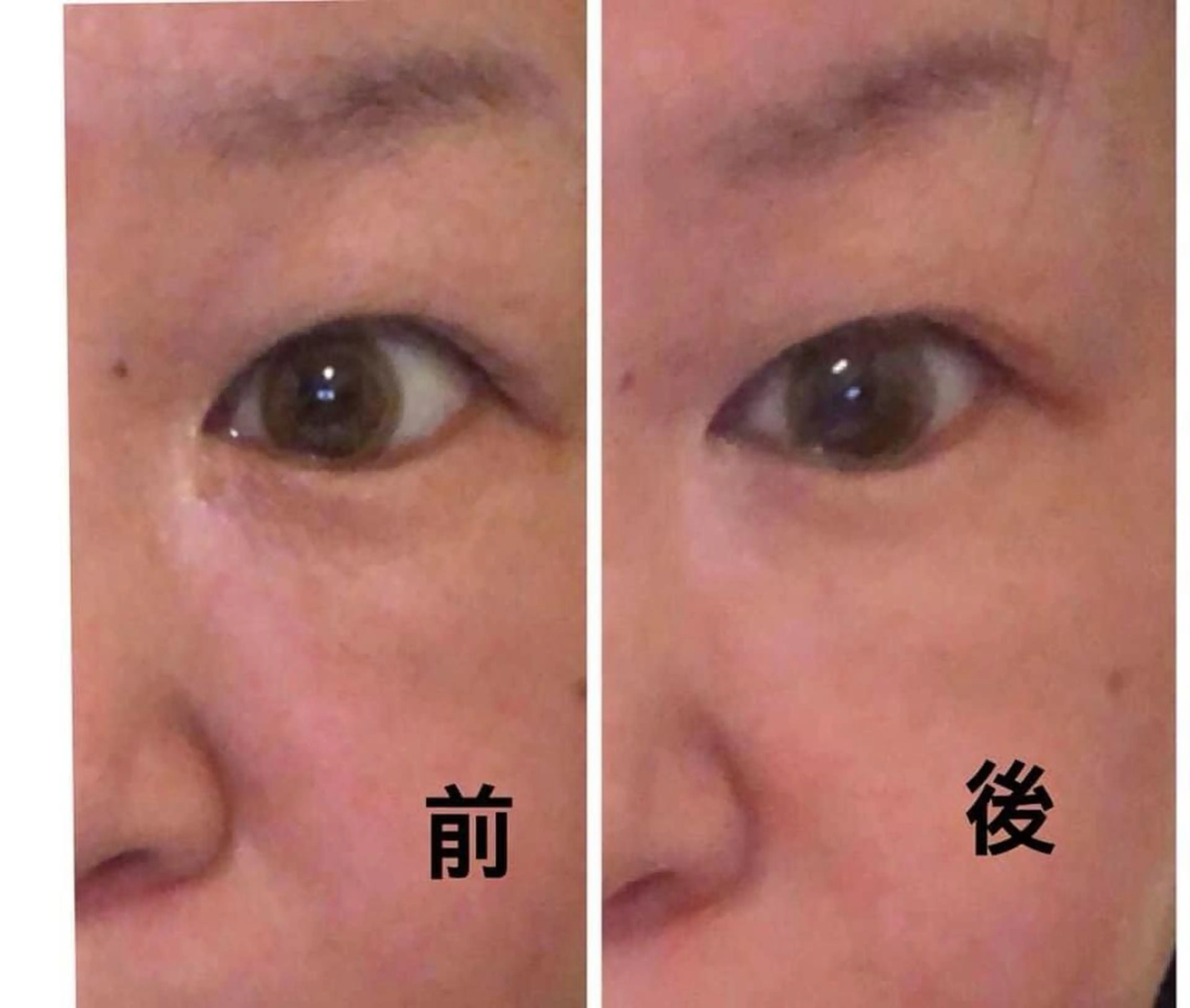 🌹角質ケアに🌹ピーリング(ゴマージュ系)+フェイシャルトリートメントの写真