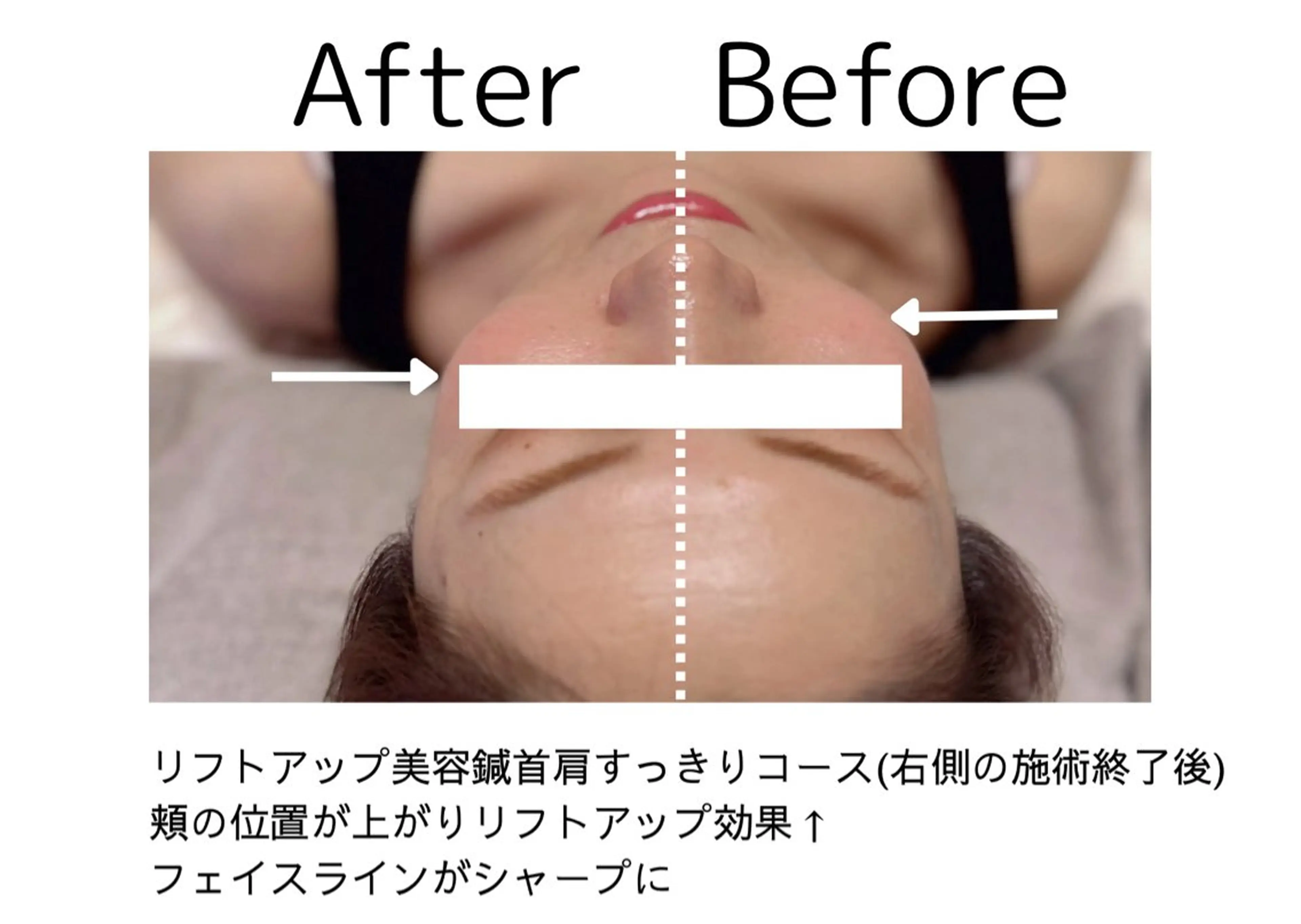 エステ リラク 鍼灸師 NARUMIのエステ・リラクイメージ