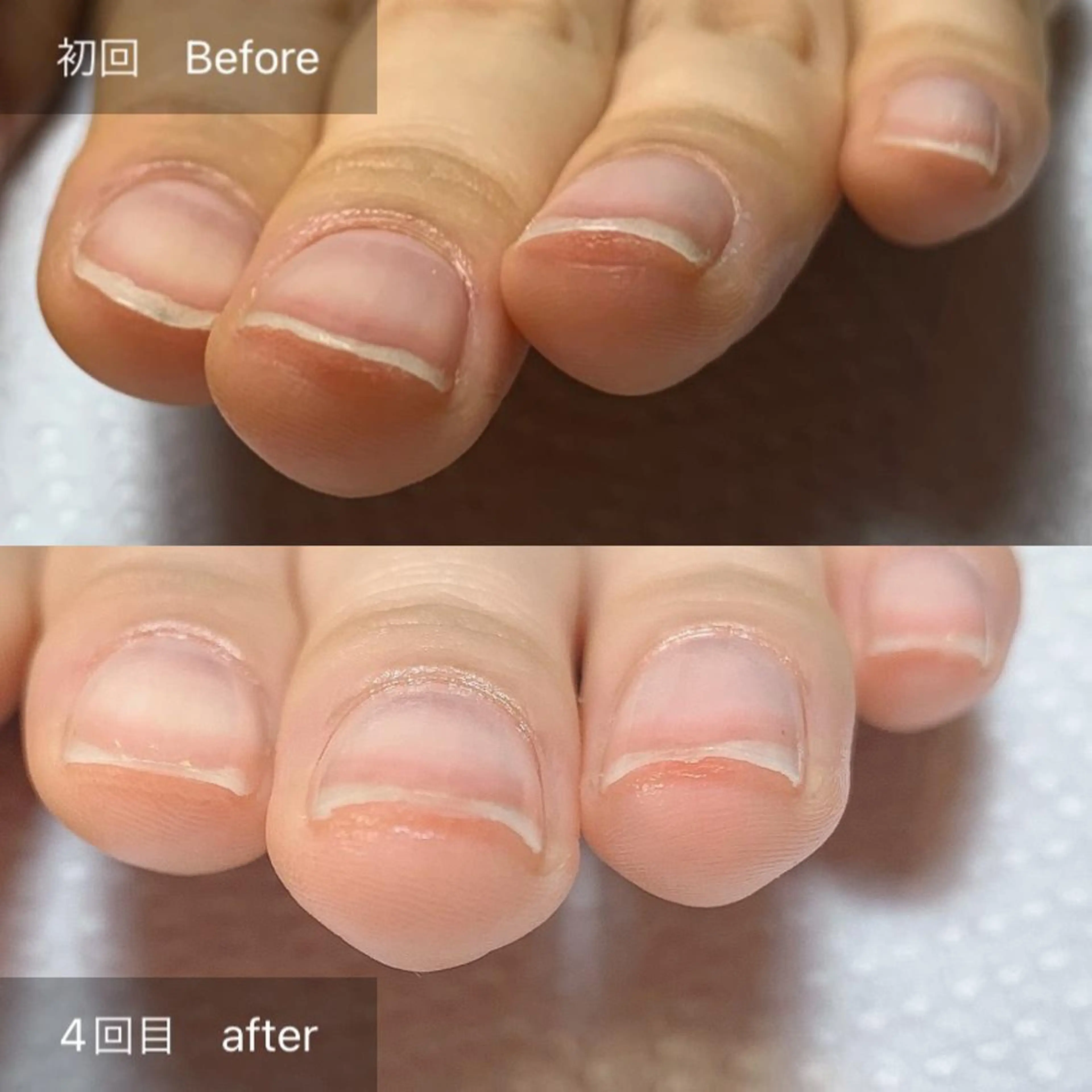 ネイル その他(ネイル) 木村 千晴のネイルデザイン