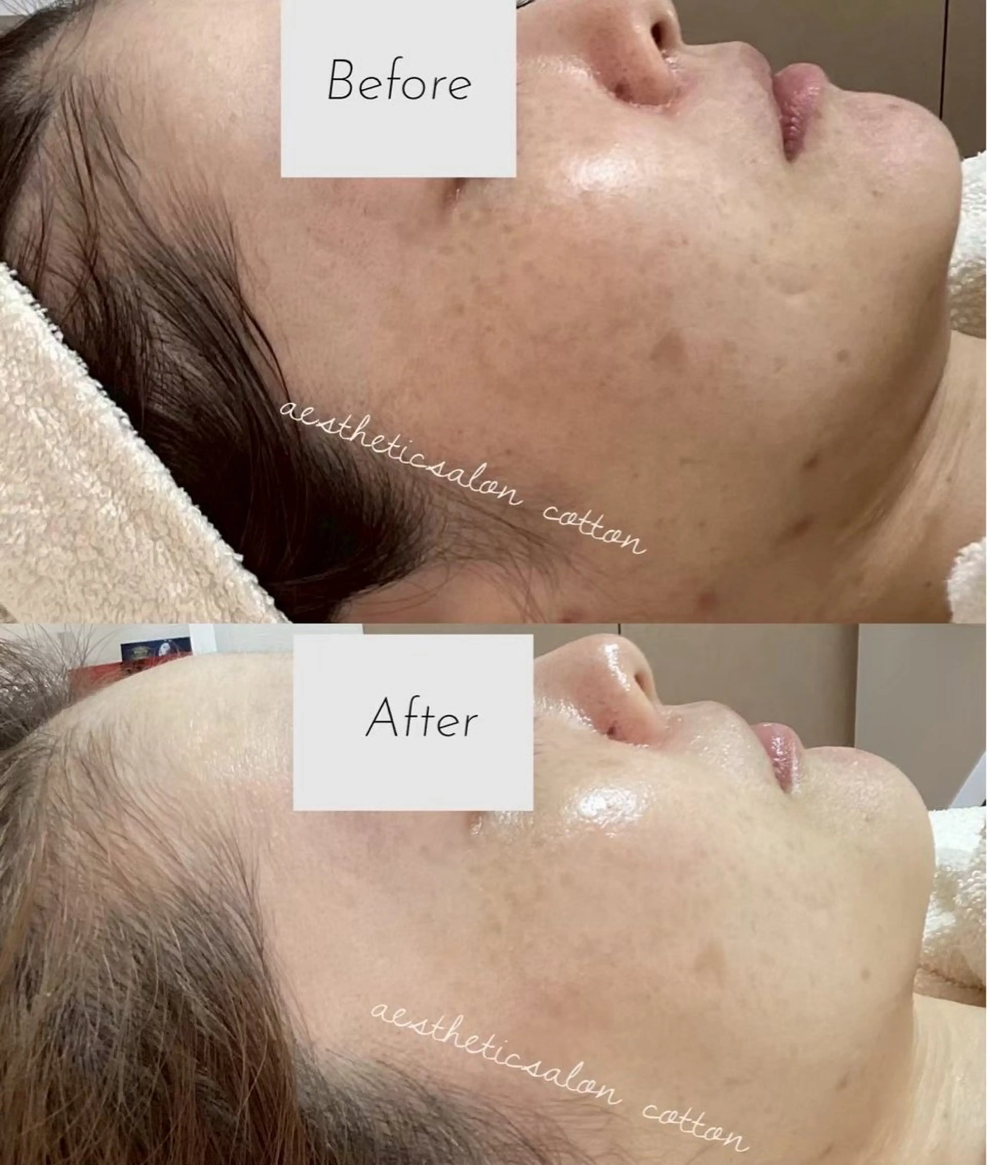 エステ 都度払い 肌質改善専門サロンのエステ・リラクイメージ