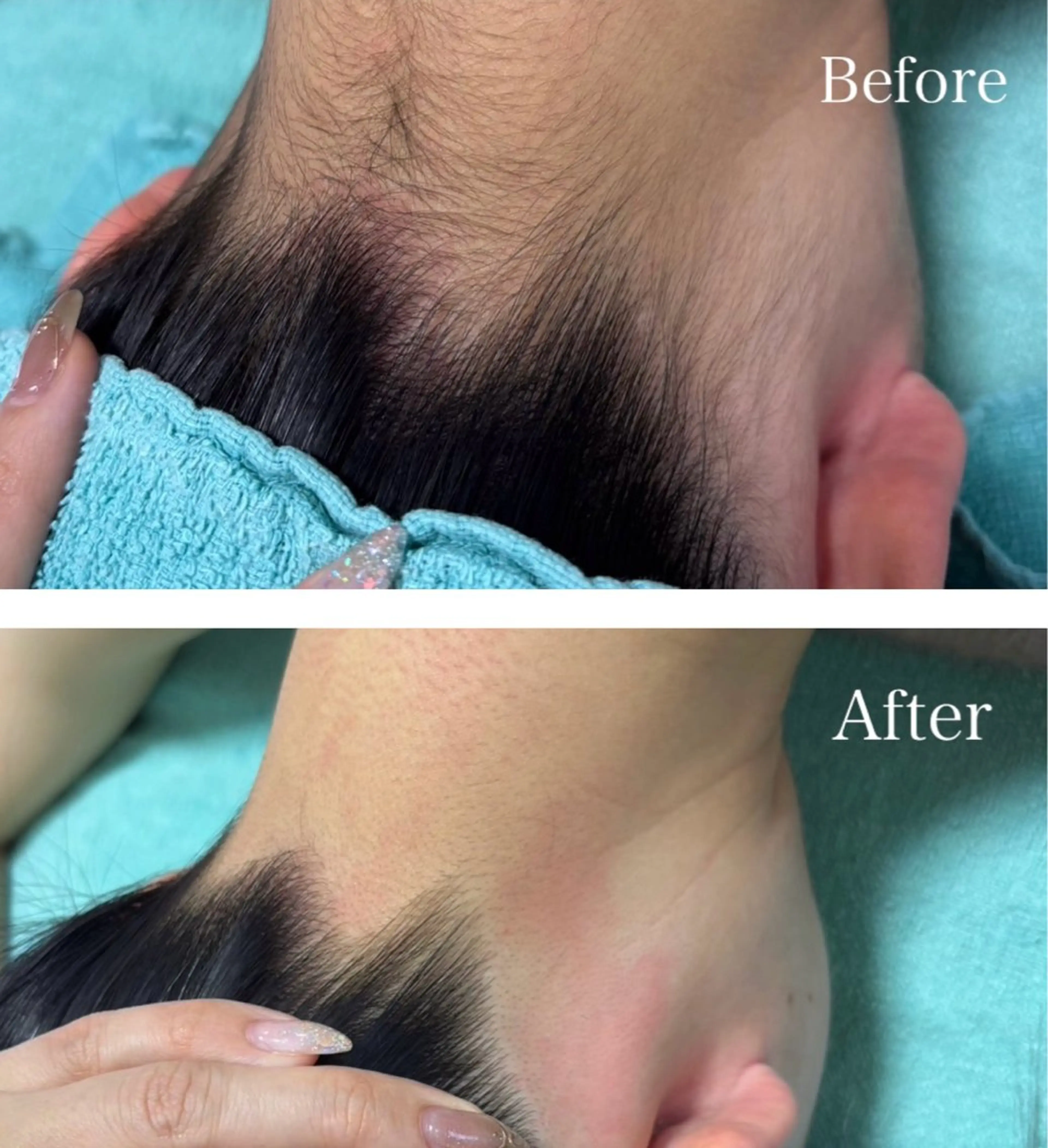 ミニモ学割 ミニモ初回限定の学生特別価格です🌟学生通常価格8800円（お友達紹介で8千円で通えます)VIO.顔含むの写真