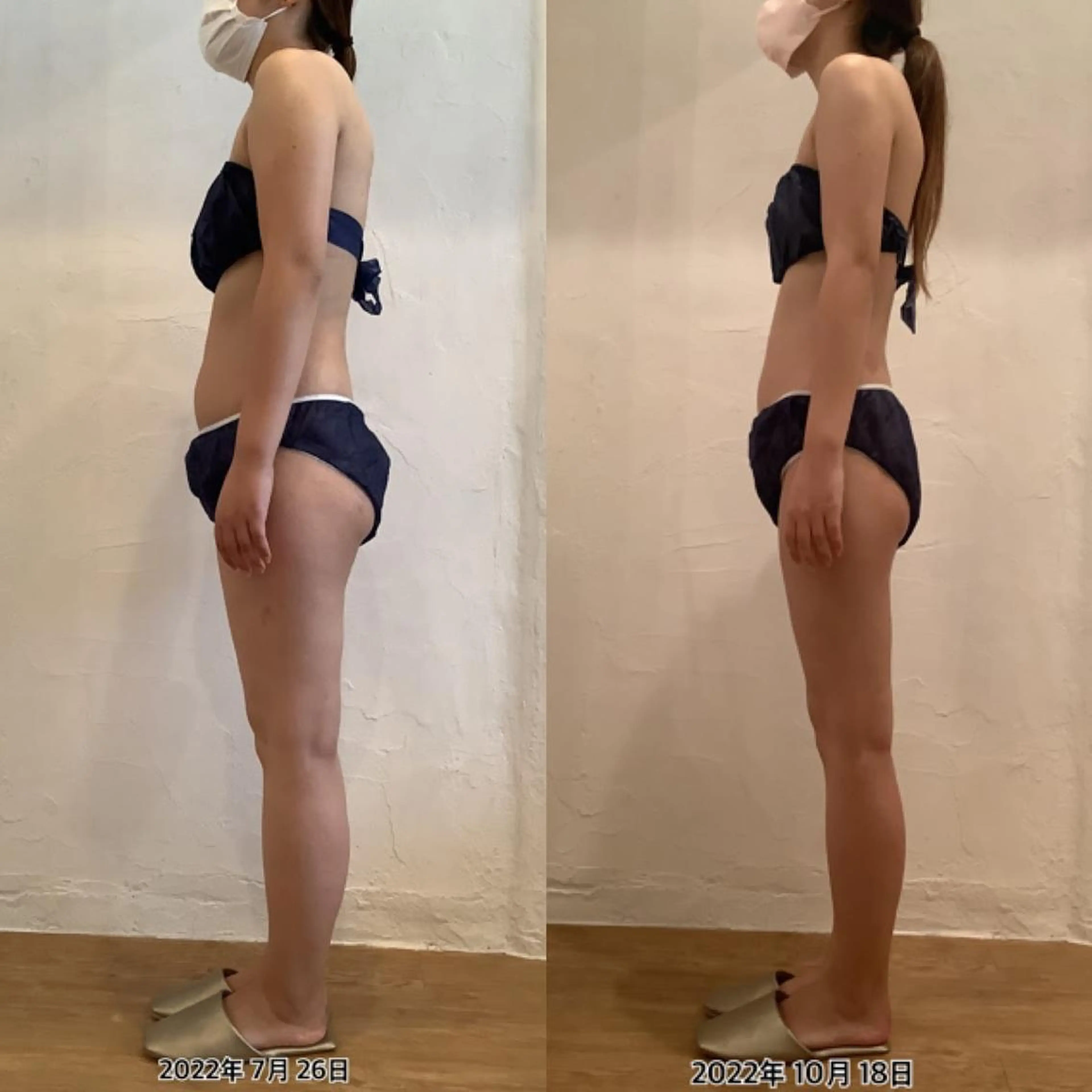 エステ リラク むくみ専門痩身 マクイエステティックのエステ・リラクイメージ