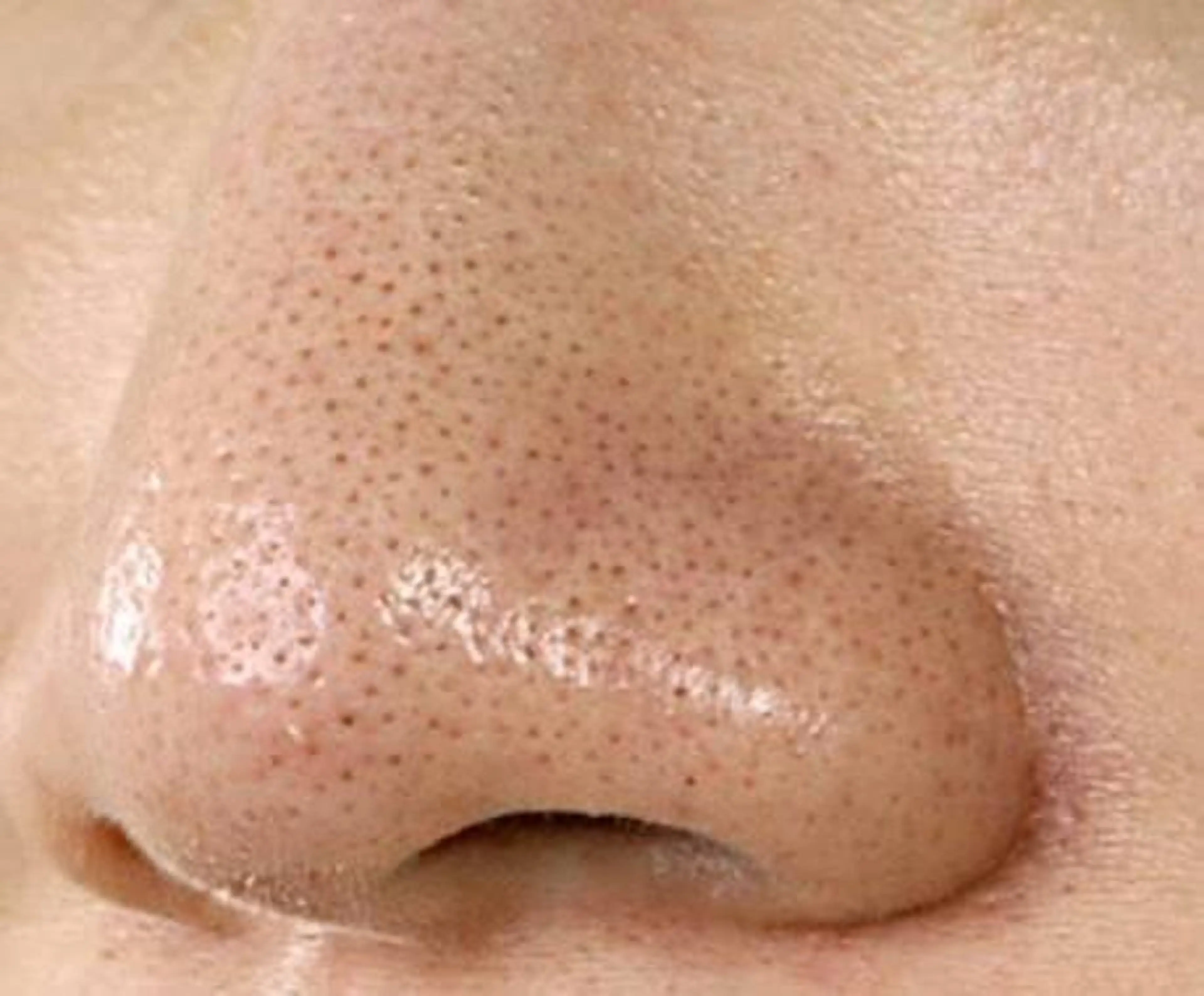 【毛穴リセットつるん肌！！】天然モロッコクレイパックフェイシャル 50分★毛穴の開き・黒ずみ・ニキビ予防に。の写真