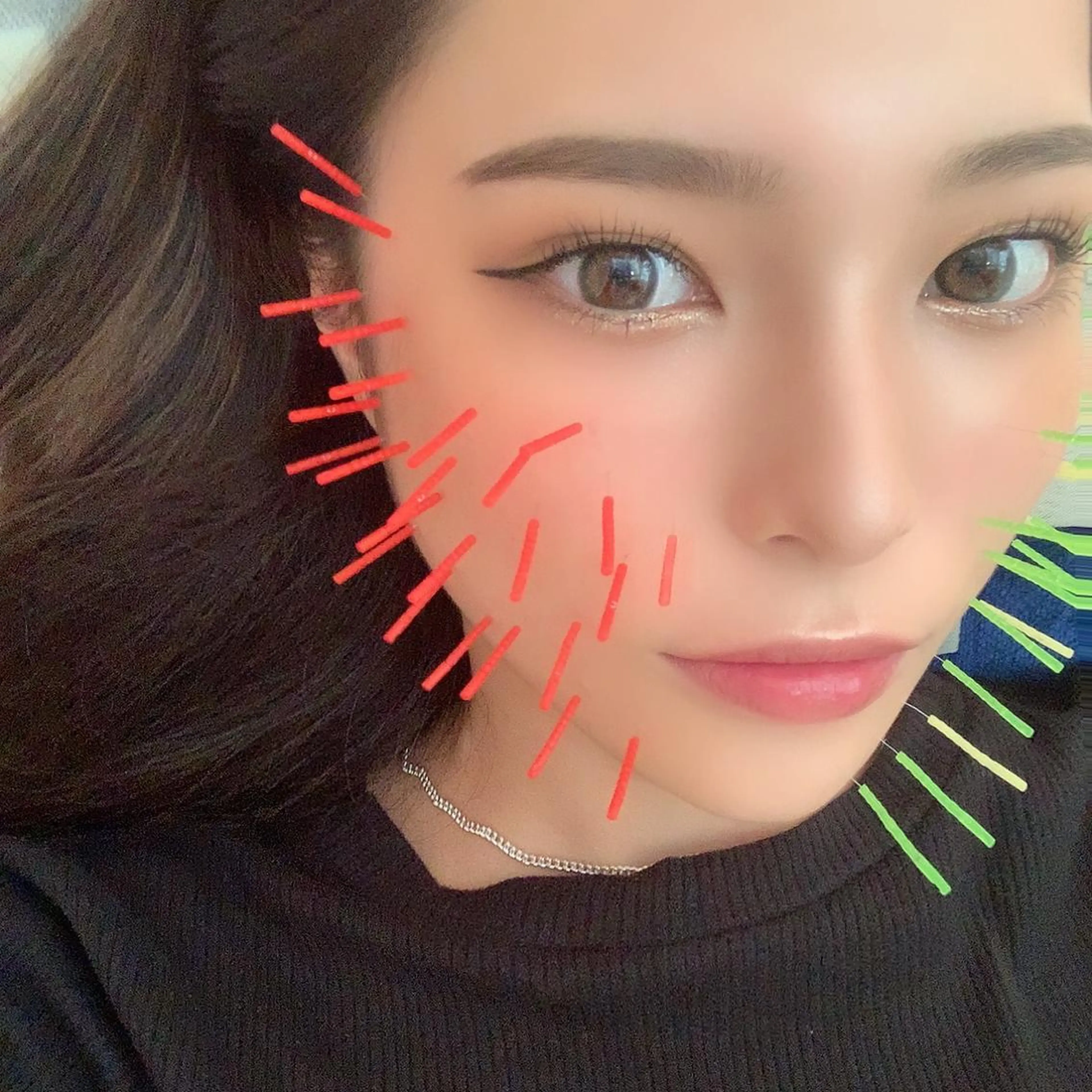 鍼灸 Refineのその他イメージ
