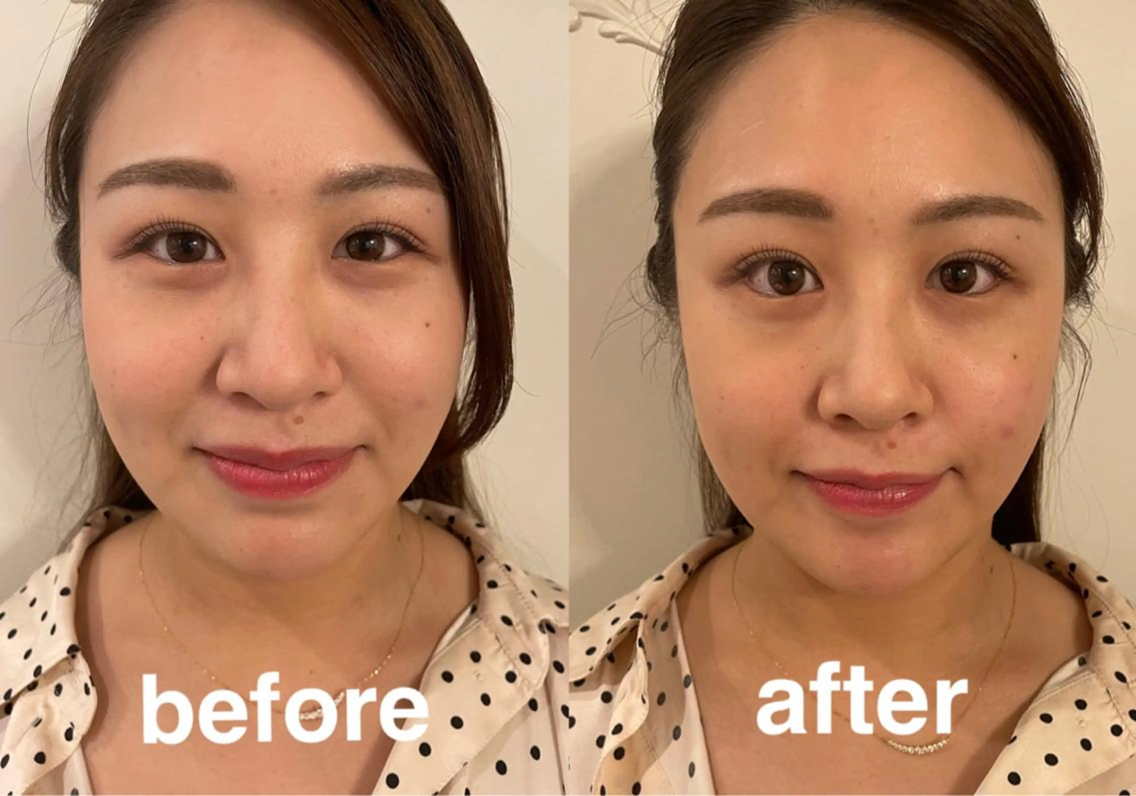 エステ リラク 美容鍼灸サロン mahoroba院長のエステ・リラクイメージ