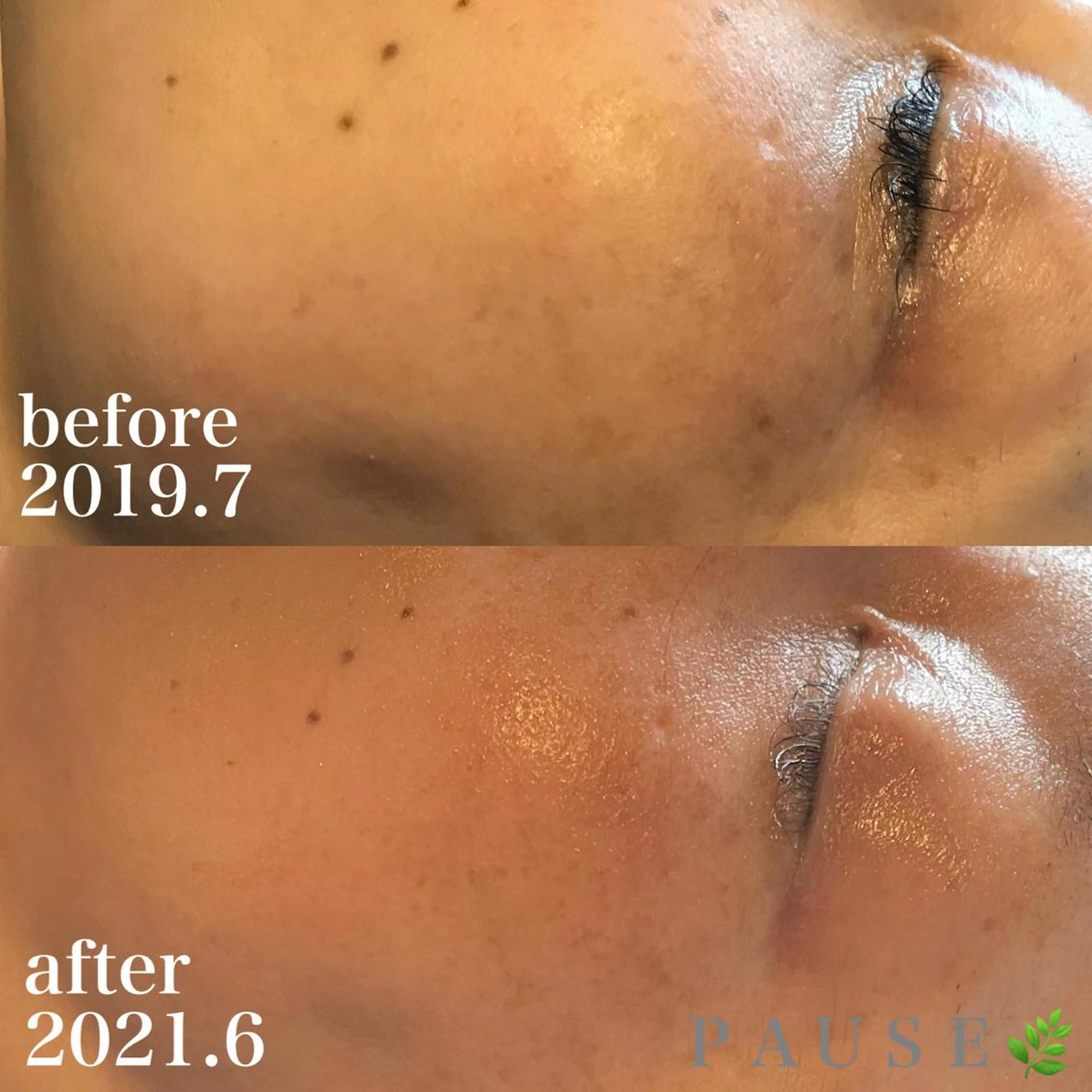 エステ 浜野 恵美のエステ・リラクイメージ