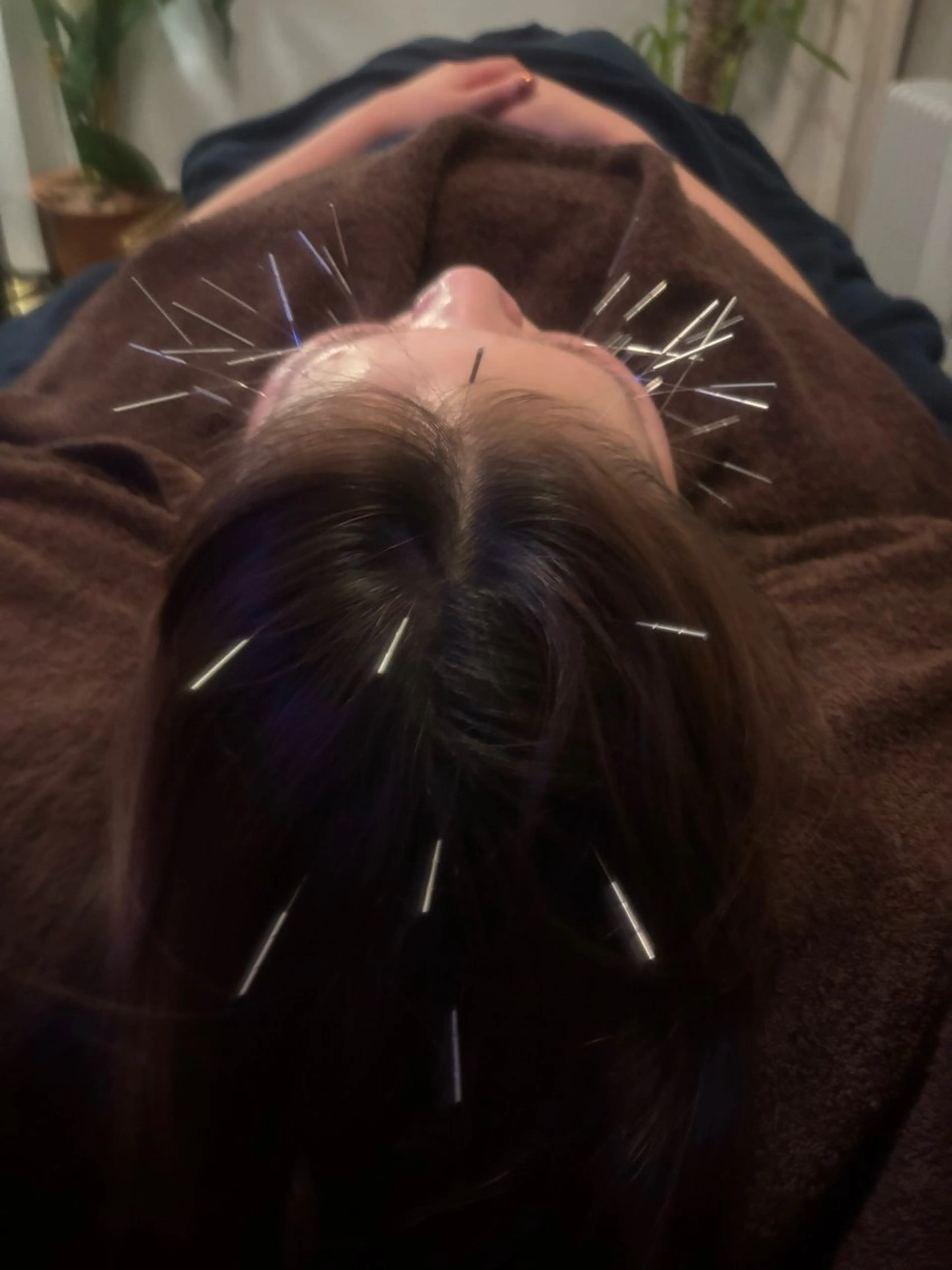 エステ 圧倒的たるみ改善 美容鍼エステのエステ・リラクイメージ