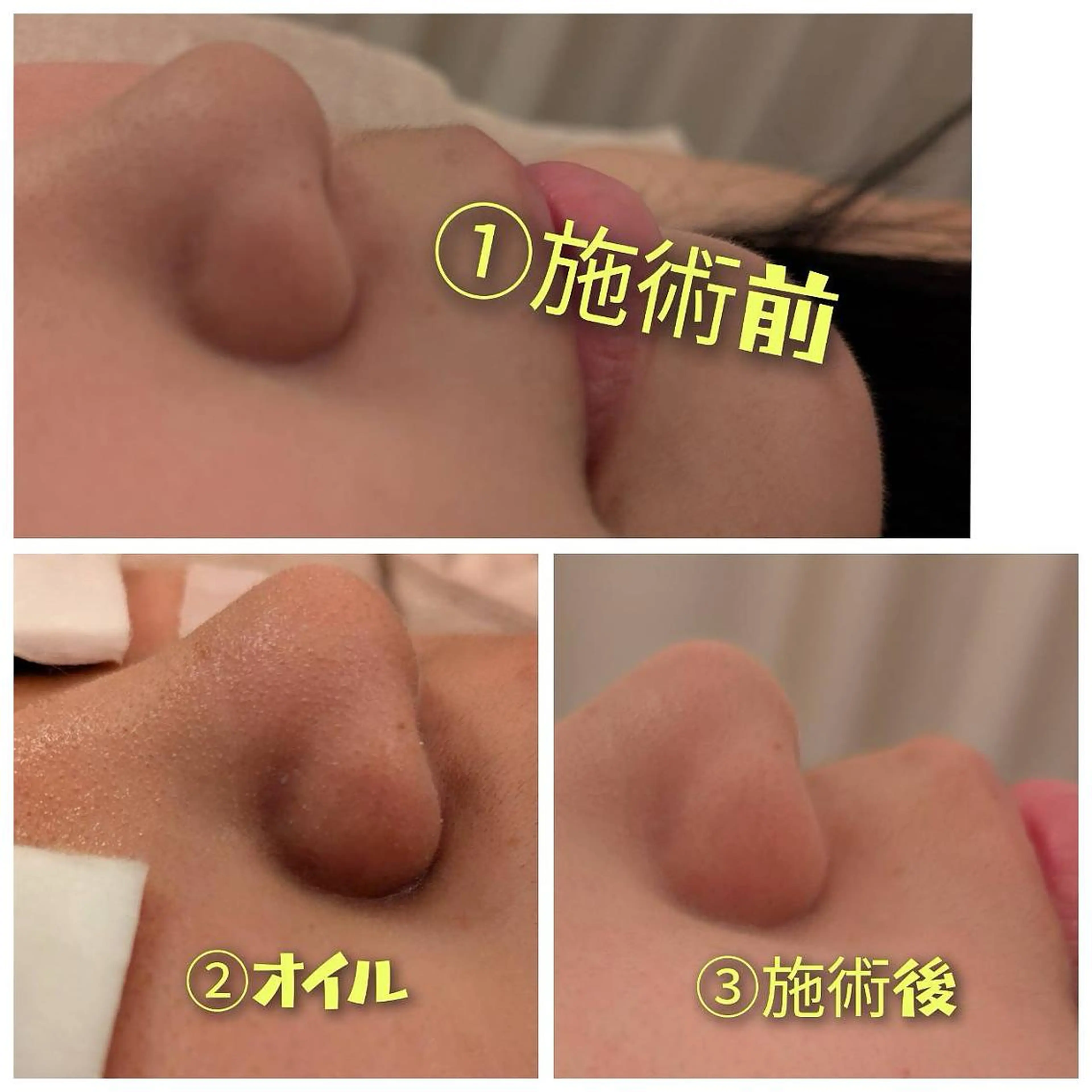 鈴木 愛花の眉毛・アイブロウイメージ