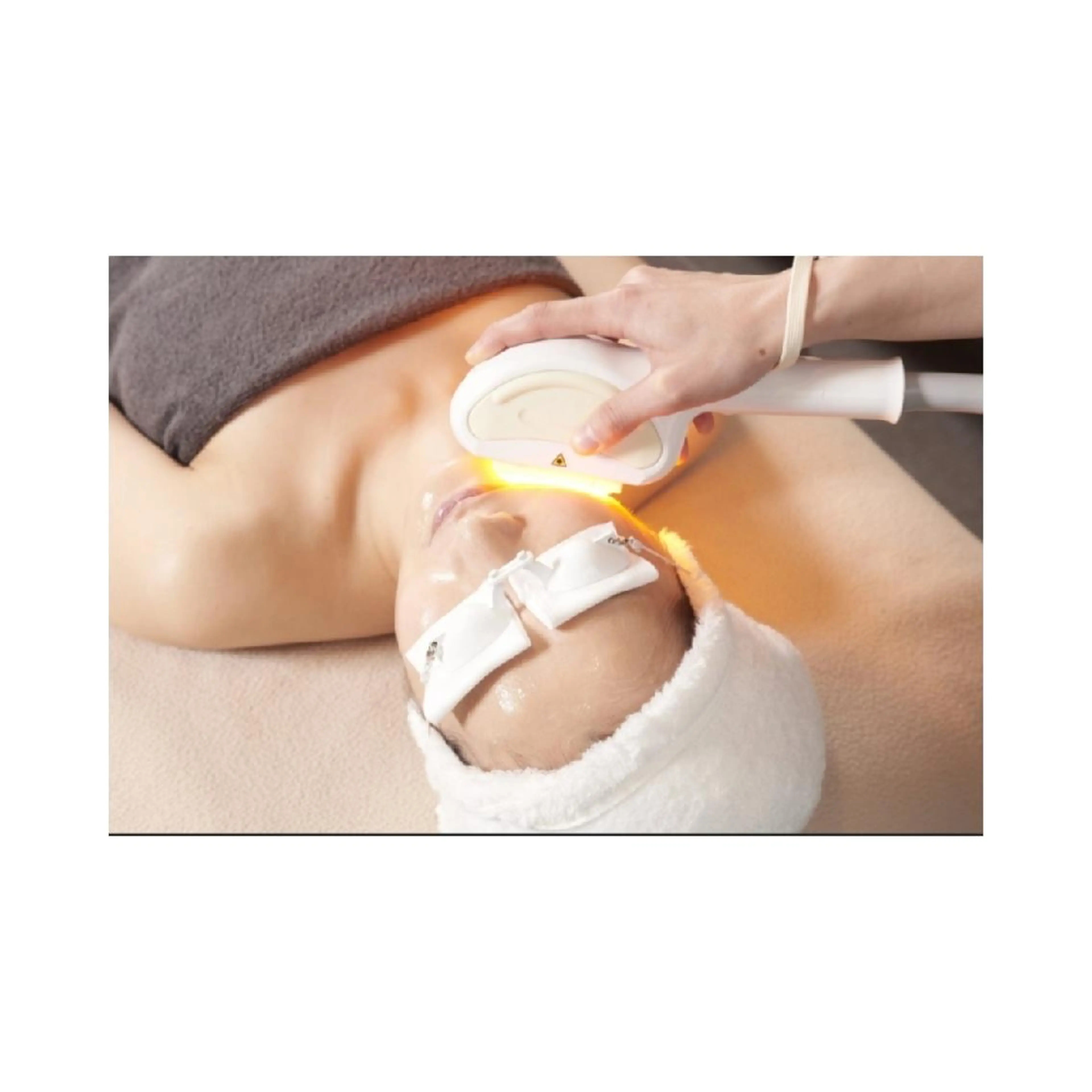 顔脱毛（おでこなし）の写真