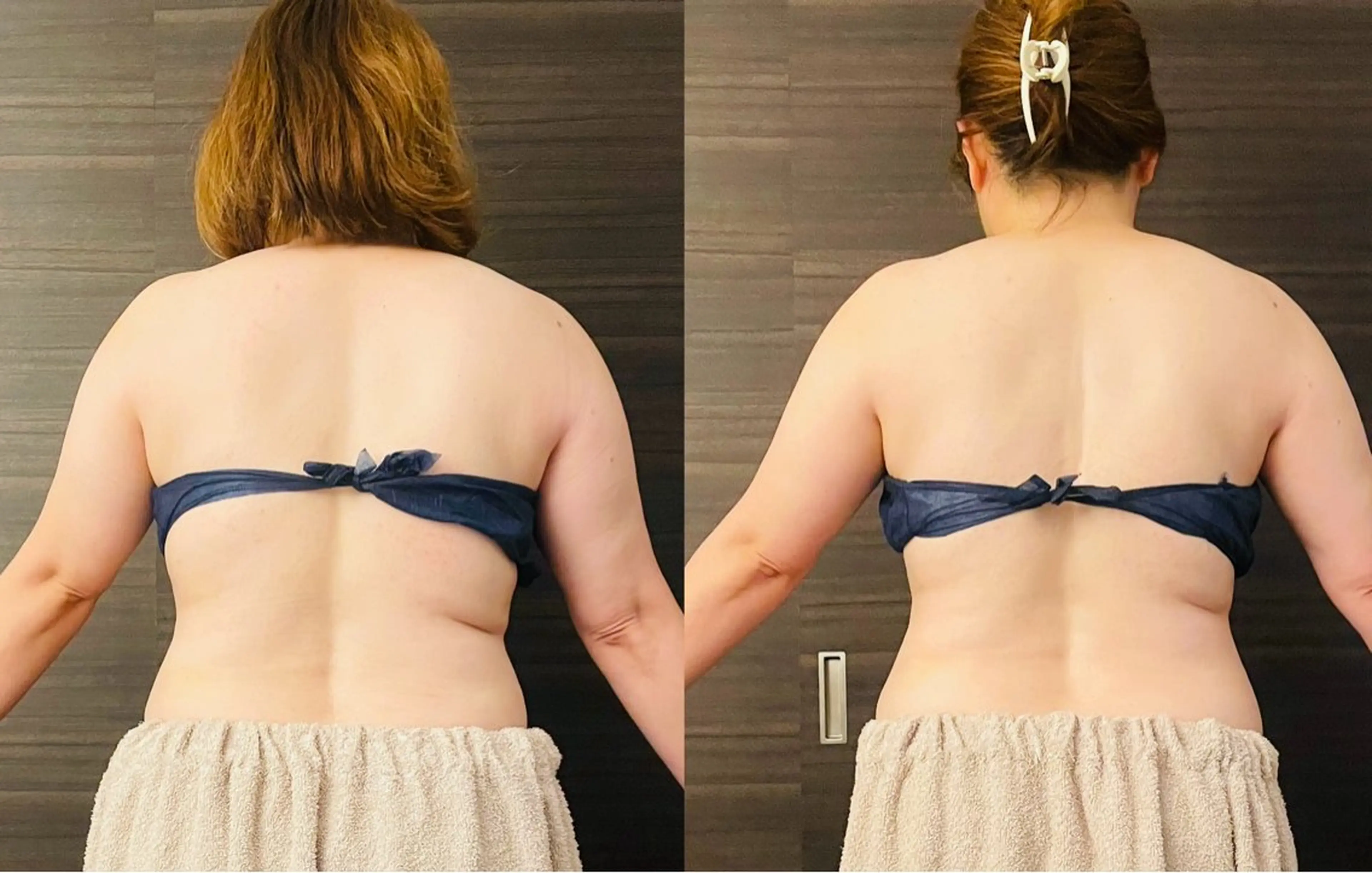 【リラク×スリミング】上半身集中トリートメント🧘‍♀️癒しだけではなく結果にこだわる。ミニモ限定バンテージ付き！の写真