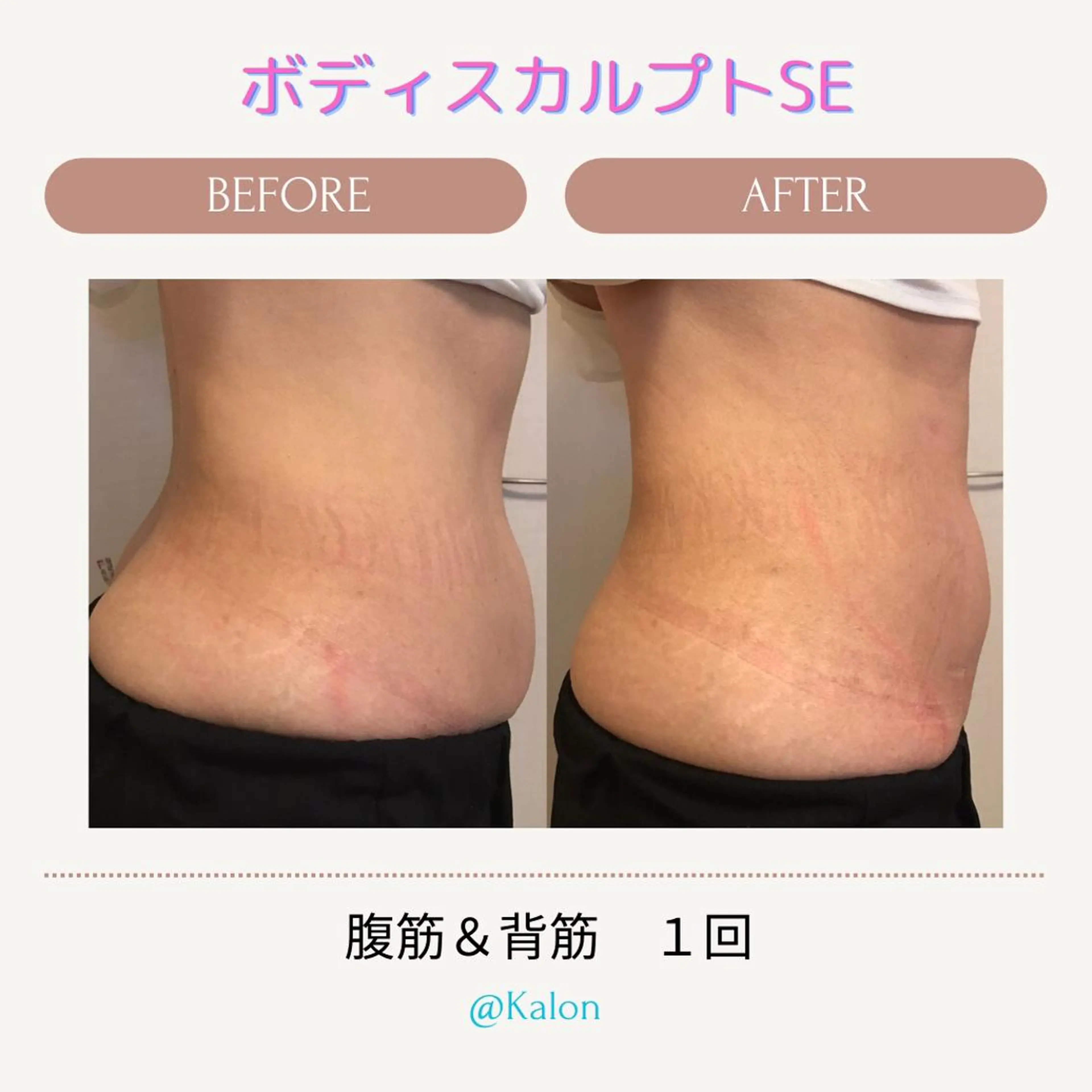 エステ 大名 Kalon（カロン）のエステ・リラクイメージ