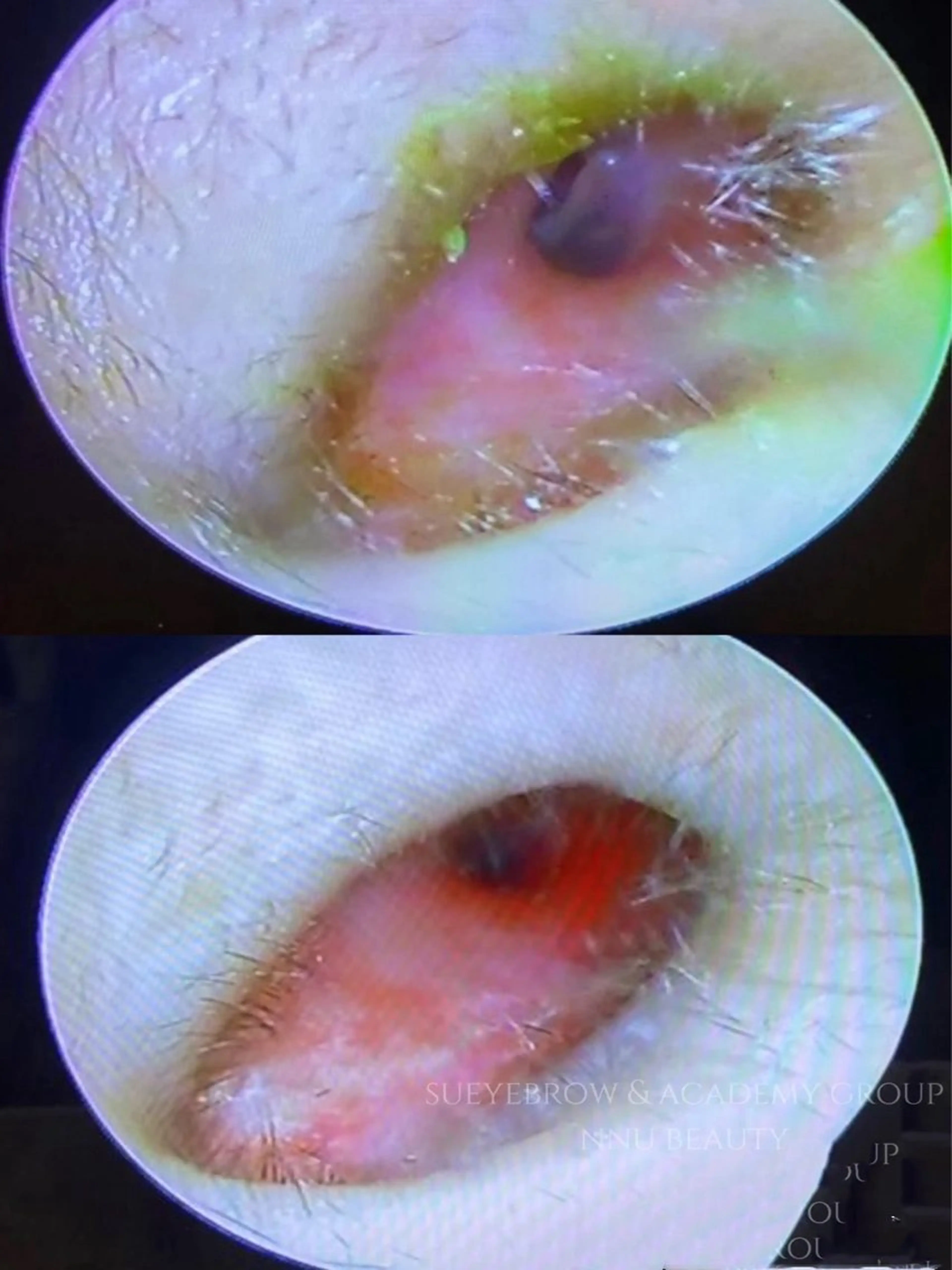 イヤーエステ ミミシャのエステ・リラクイメージ