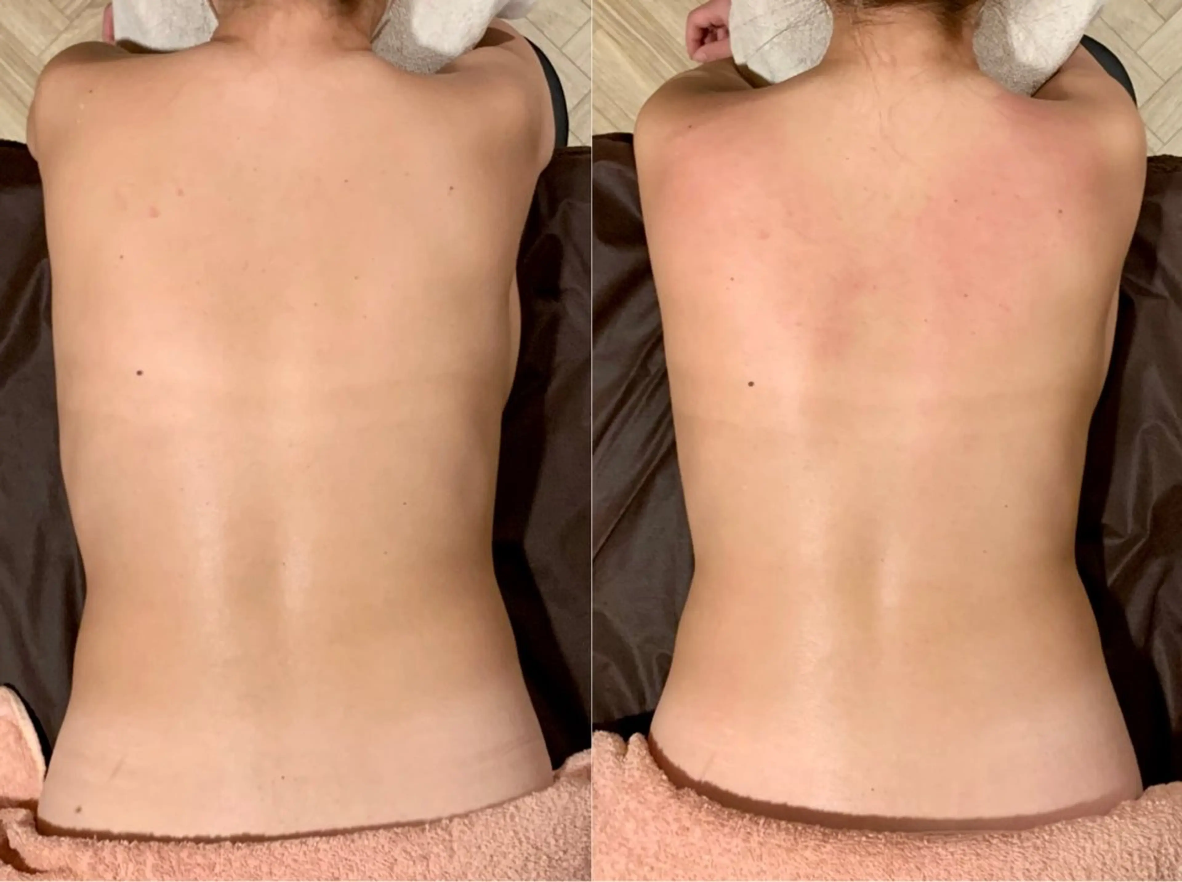 エステ リラク Rewhite -リホワイト-のエステ・リラクイメージ