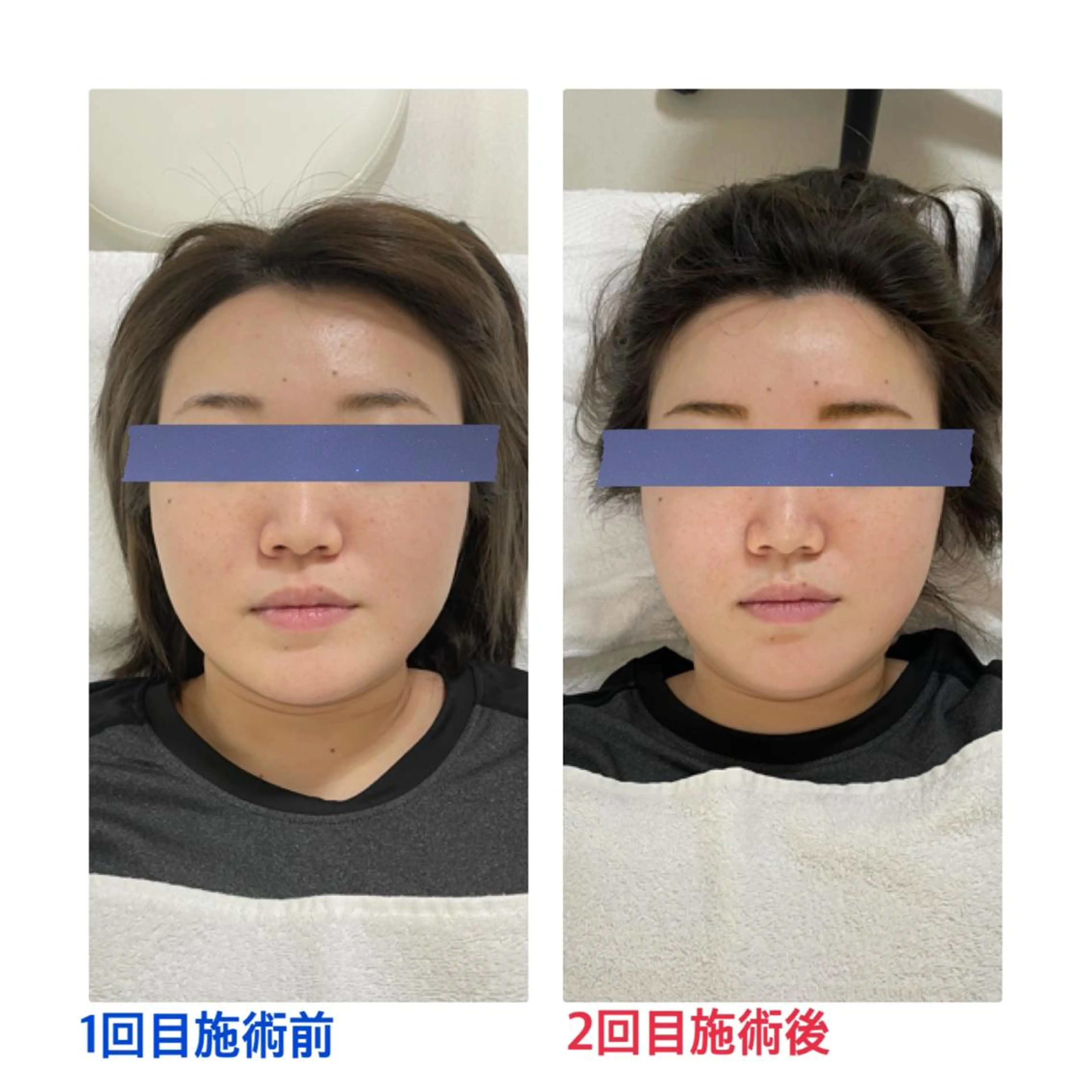 エステ リラク プライベートサロン moyoのエステ・リラクイメージ