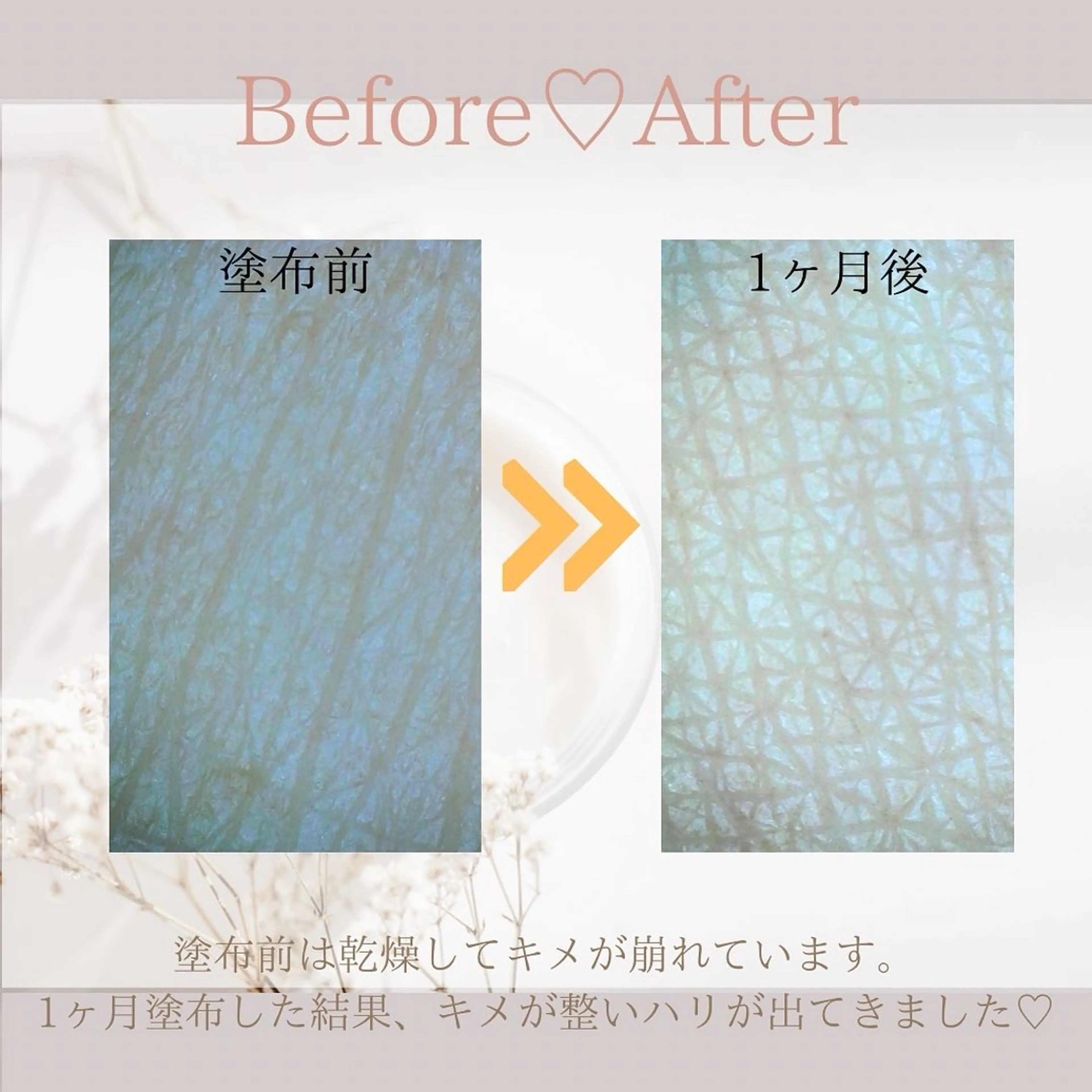 Mr.&Ms.脱毛/ ピーリング/RINAのエステ・リラクイメージ