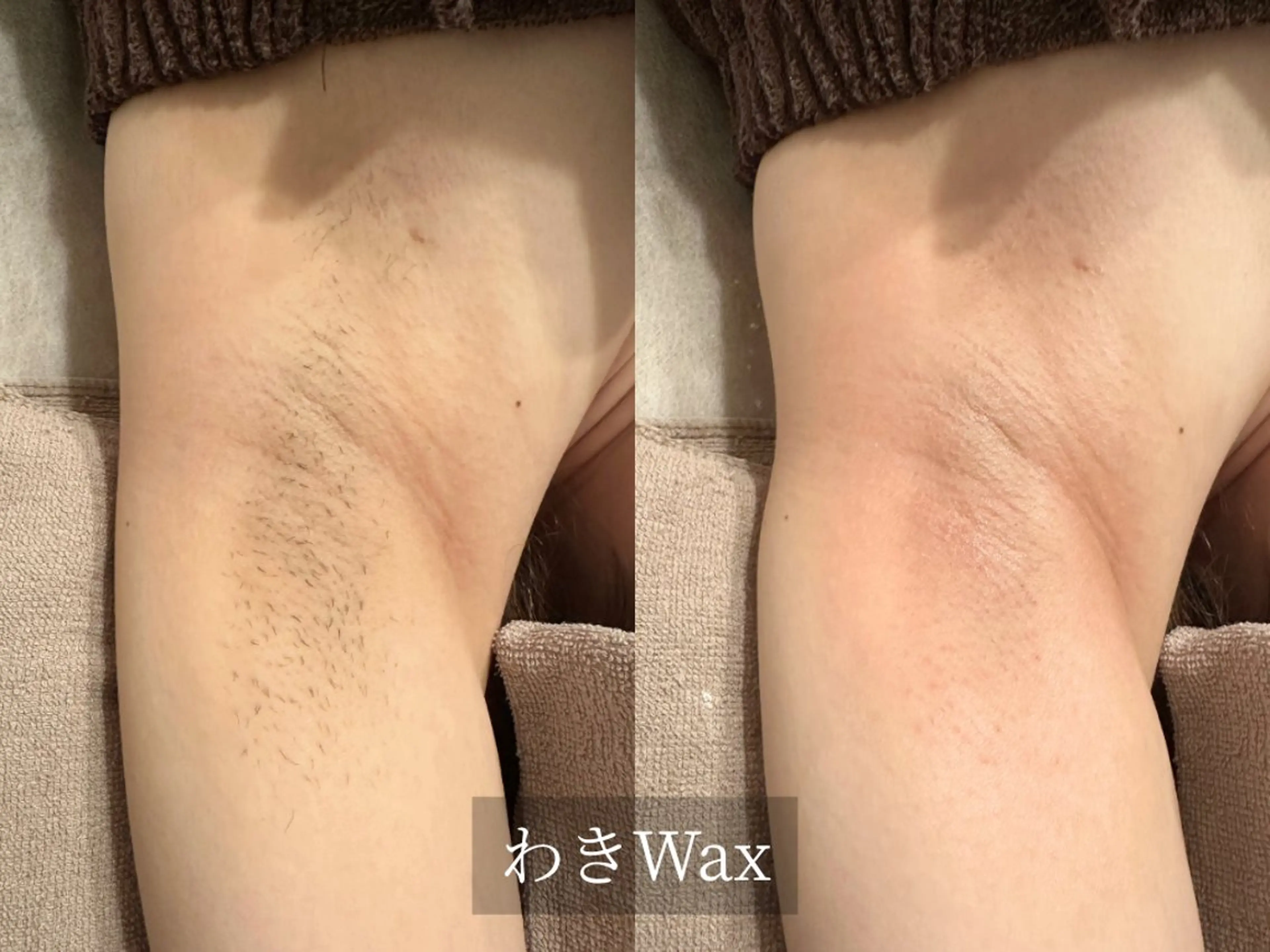 脱毛サロン Arumのエステ・リラクイメージ