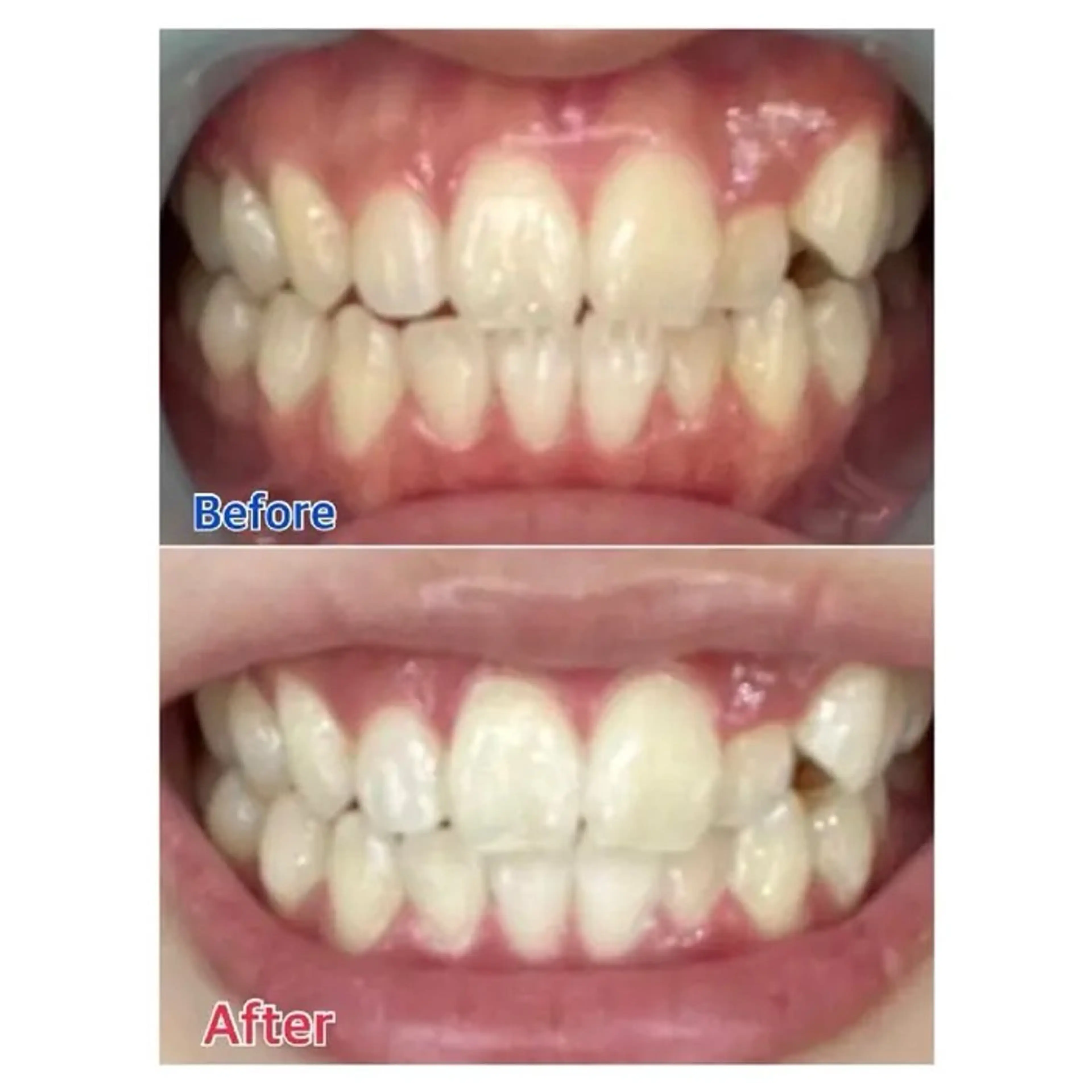 M渋谷 ホワイトニングのエステ・リラクイメージ