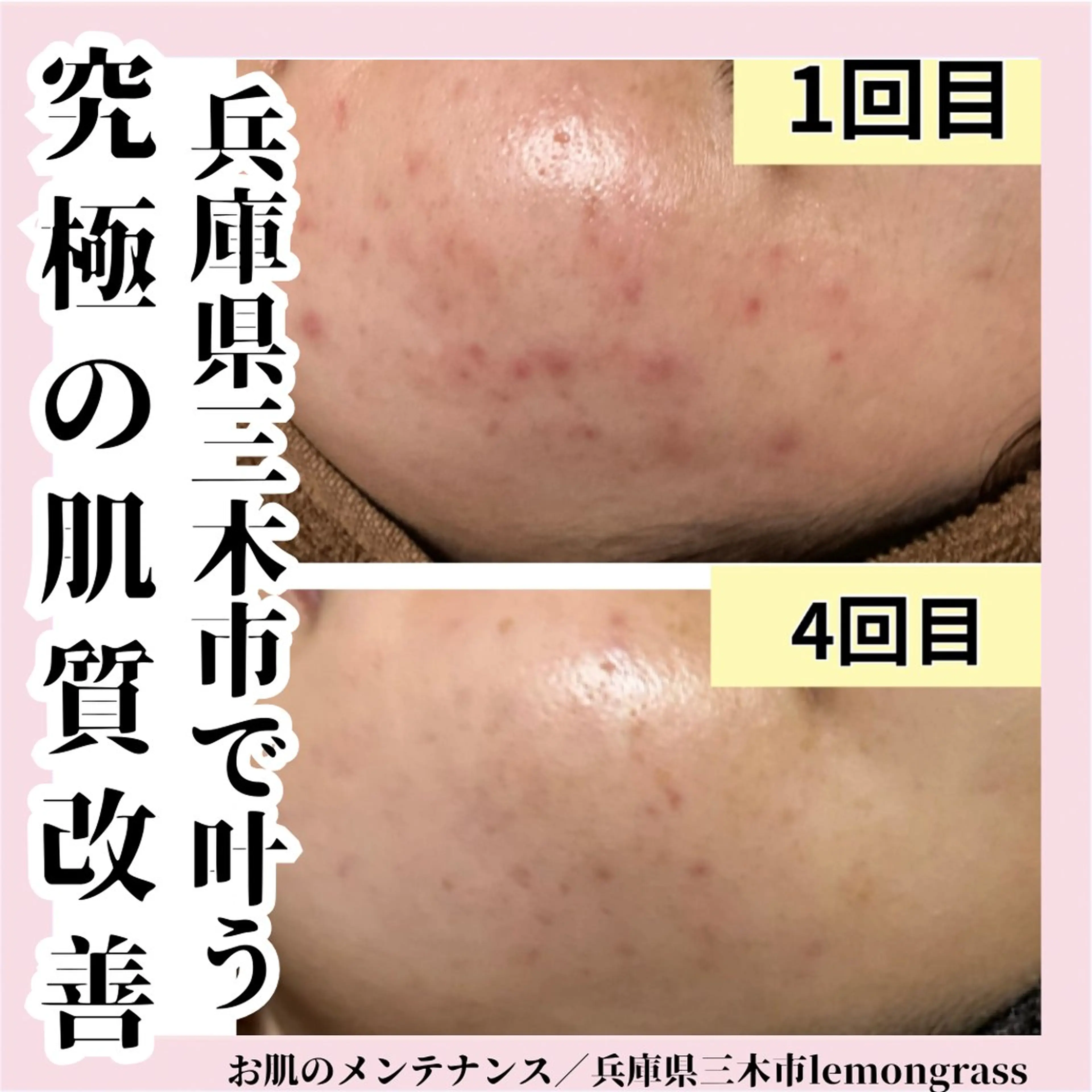 エステ ハーブピーリング 専門／今榮麻美のエステ・リラクイメージ