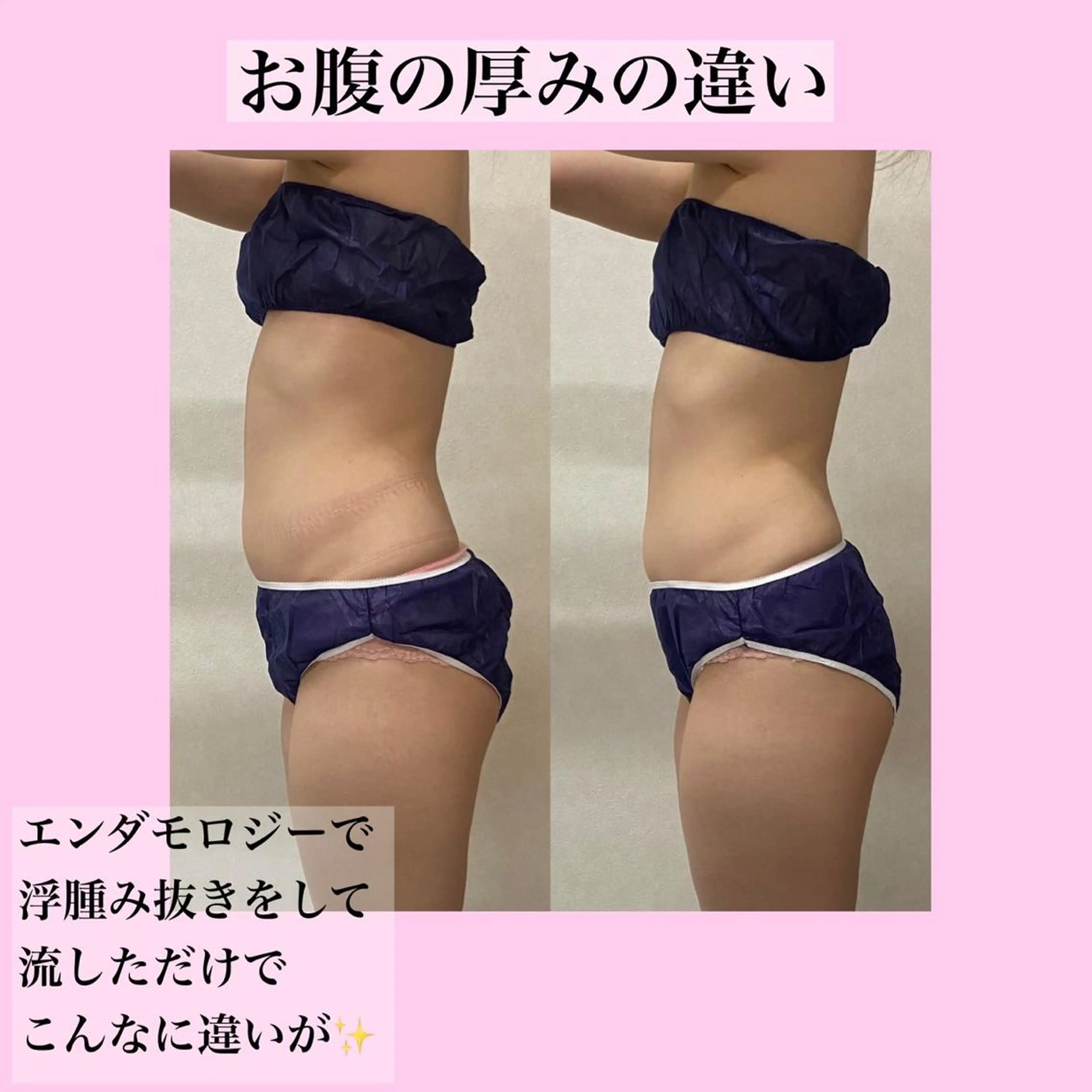 エステ B againのエステ・リラクイメージ