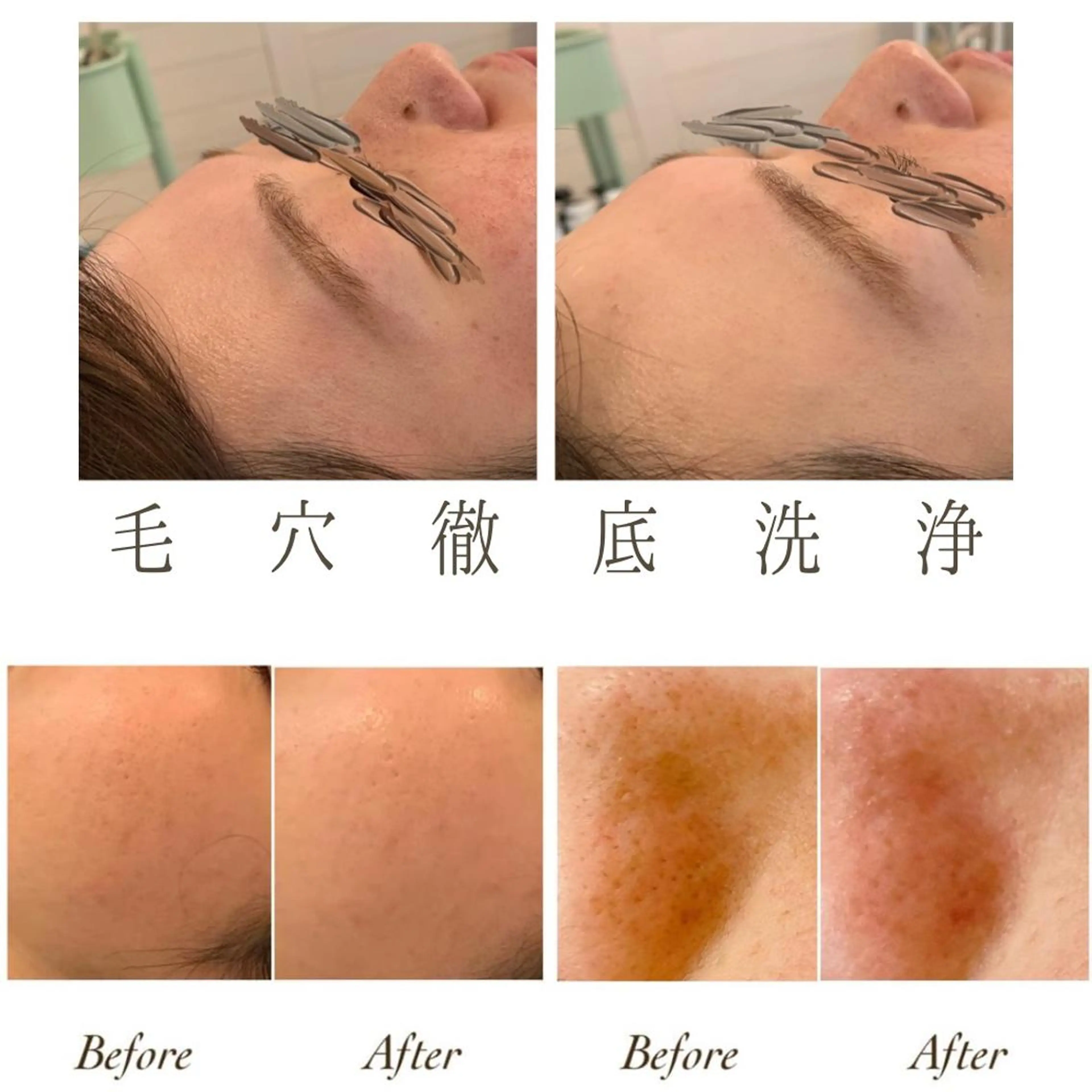 ange rose所属・竹澤 亜希子のエステ・リラクイメージ