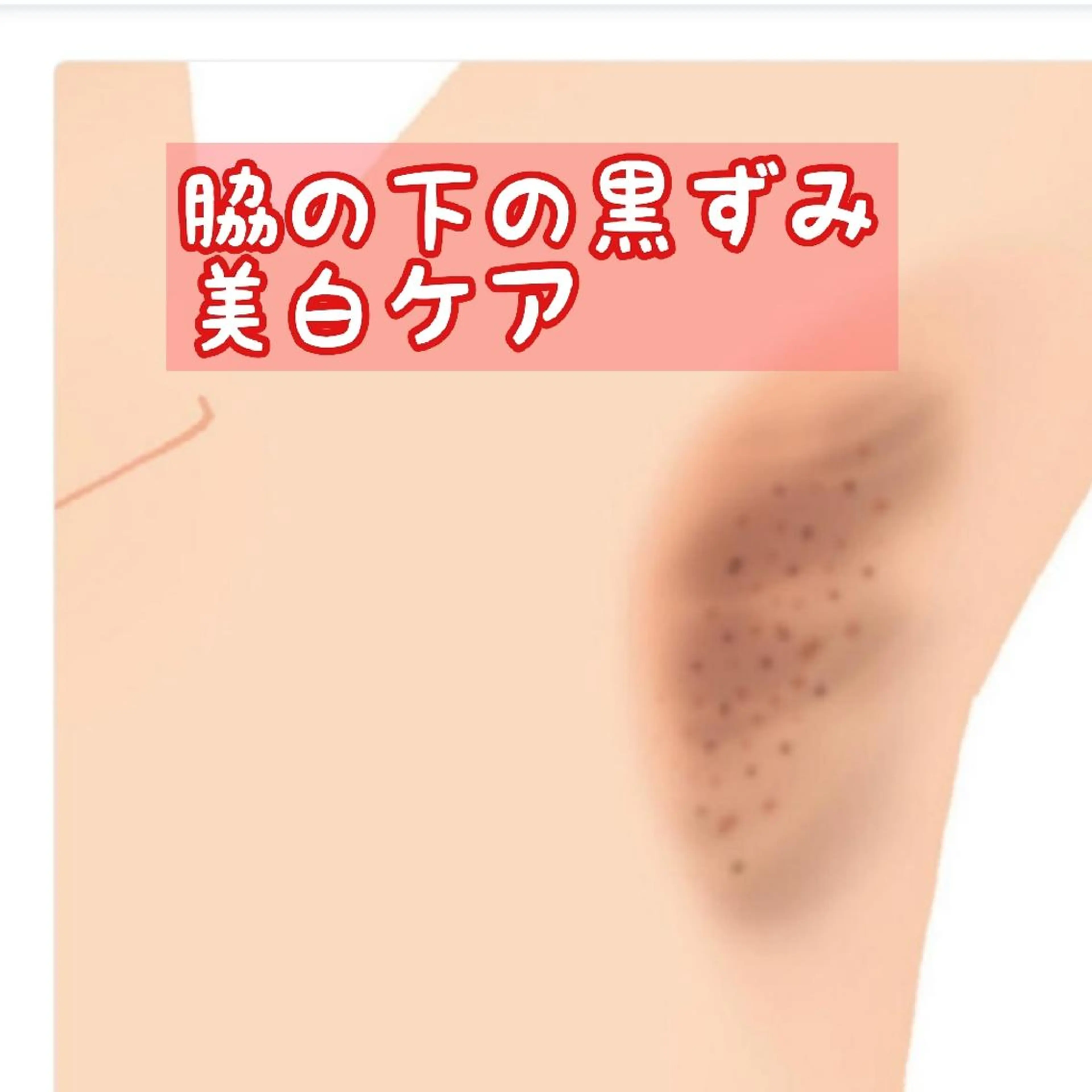 仮予約お得🉐🌸🌈脇の下黒ずみケア🌷美白保湿ケアの写真