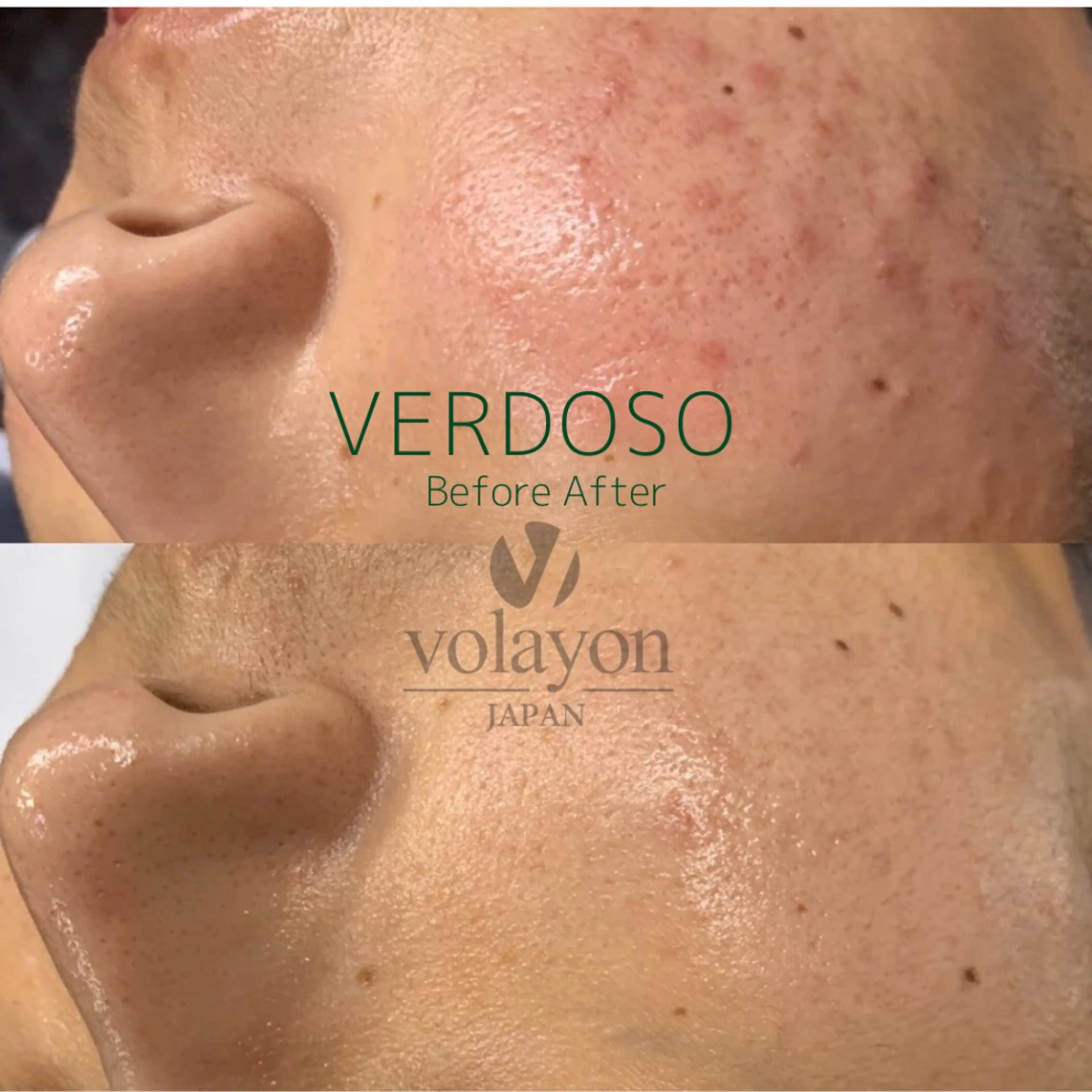 韓国肌管理★ 聖のエステ・リラクイメージ