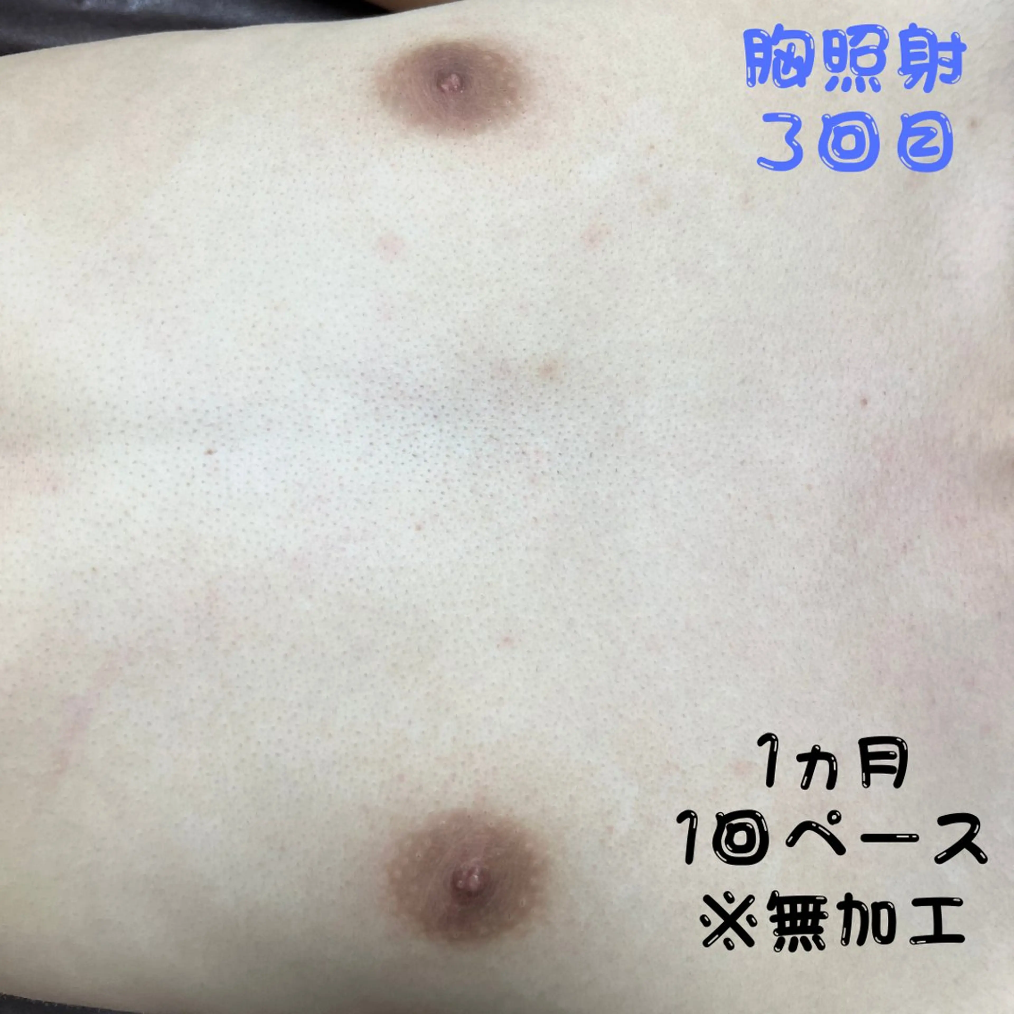 メンズ キッズ 脱毛 メンズ脱毛フェリッセ /男女🆗キッズ🆗のエステ・リラクイメージ