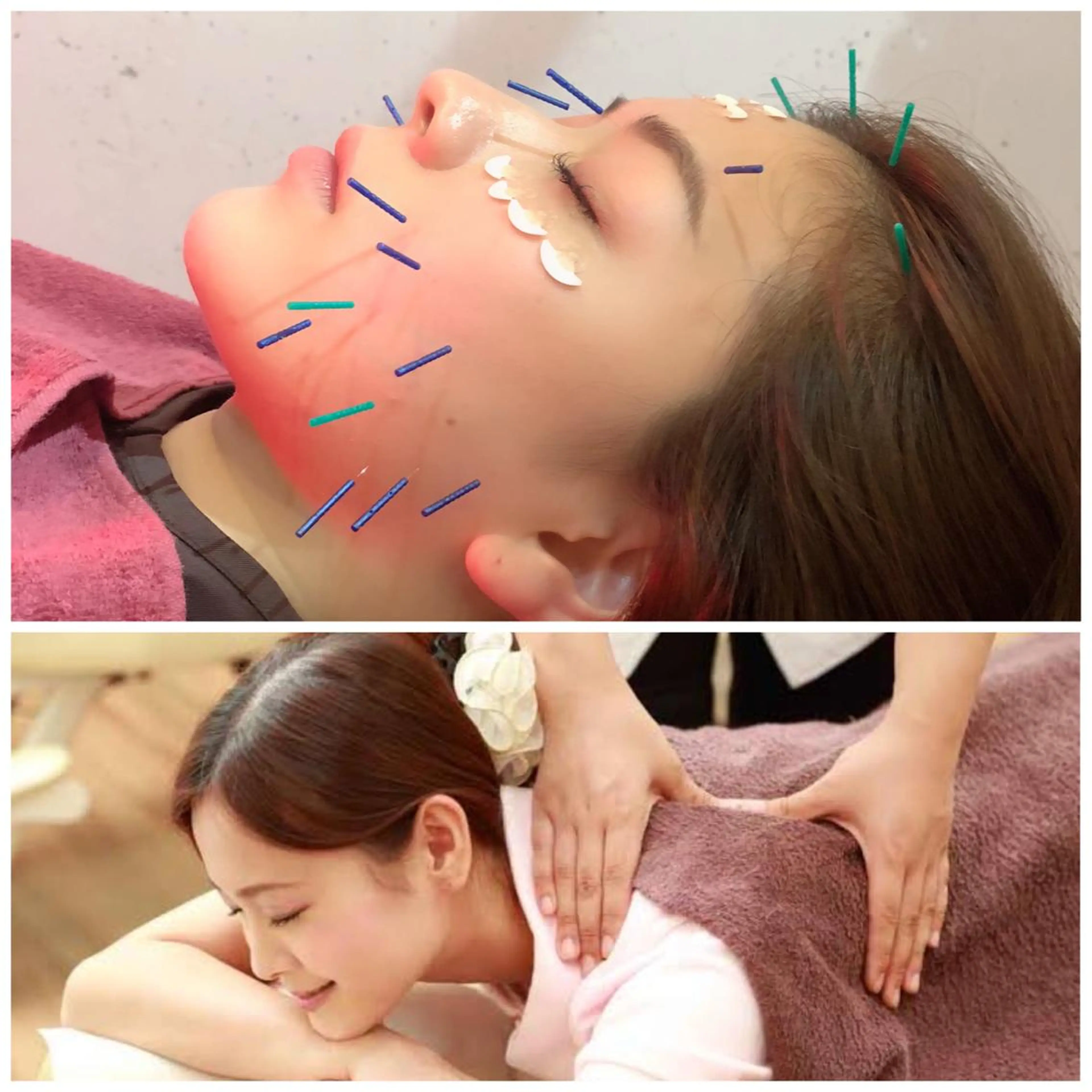 人気です⭐️ リッチボディメンテナンス⭐️全身調整⭐️マッサージとお体に鍼＆お顔に美容鍼電気鍼120分満足コースの写真