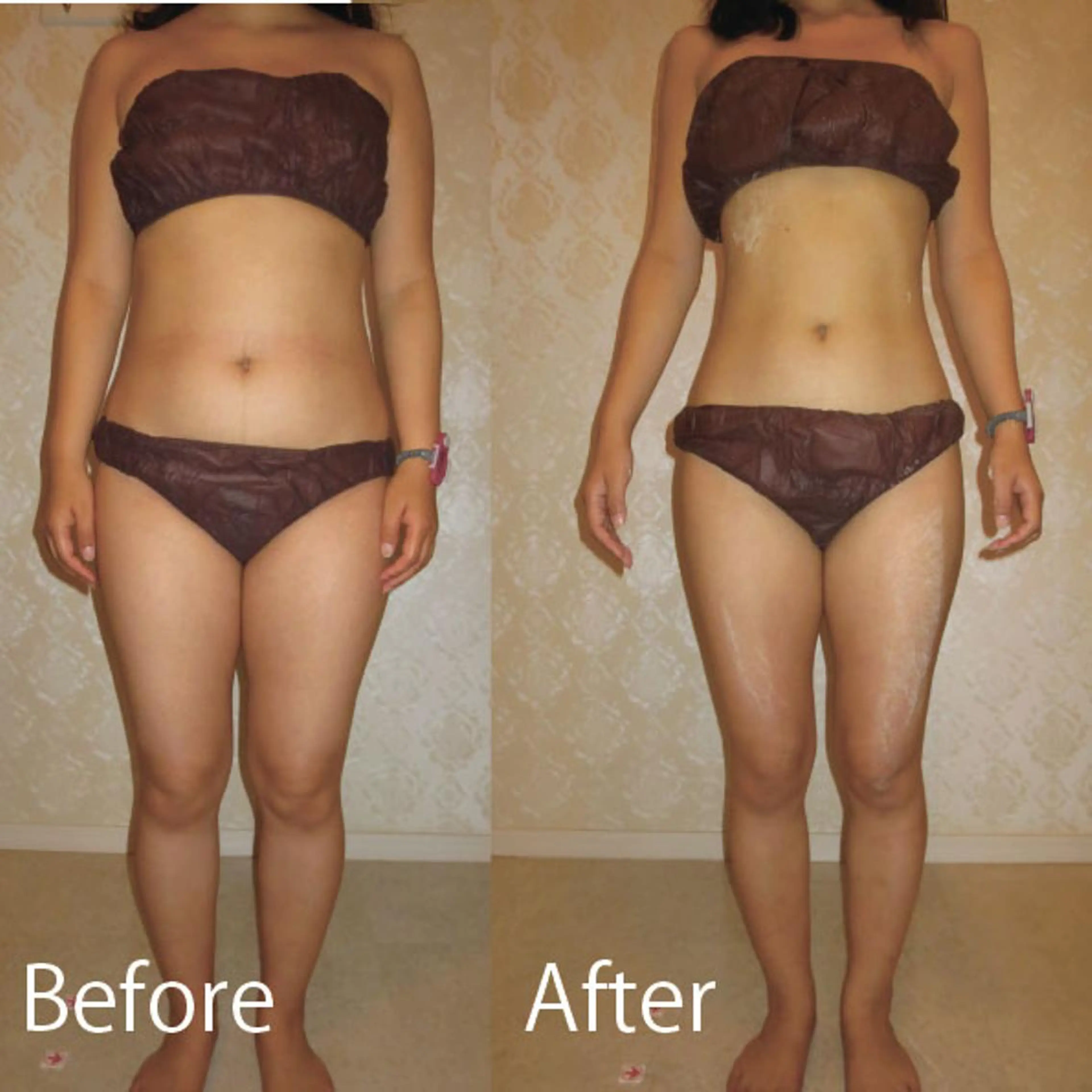 脚やせ専門ダイエット ルメートルのエステ・リラクイメージ