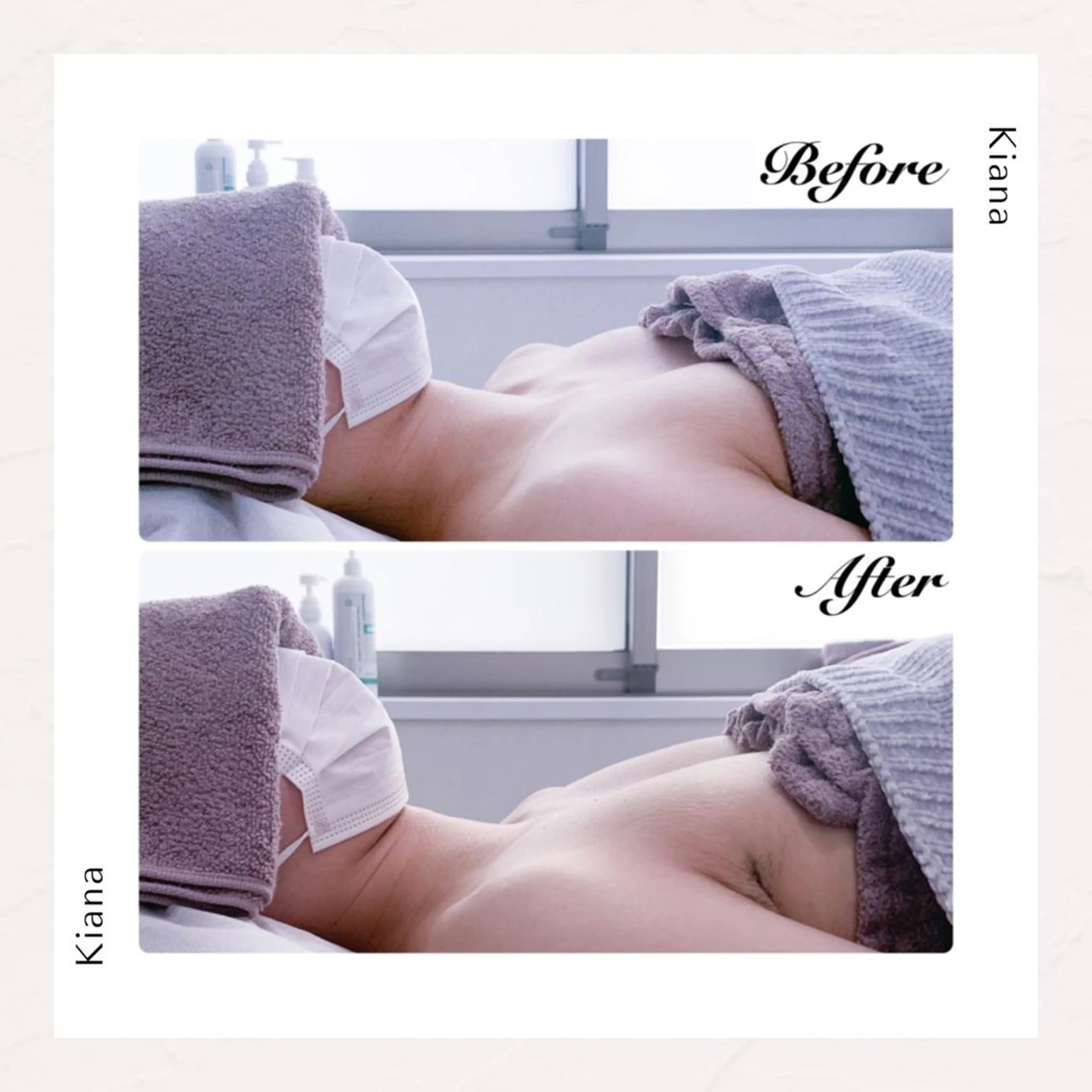 エステ リラク バスト専門Kiana 風のエステ・リラクイメージ