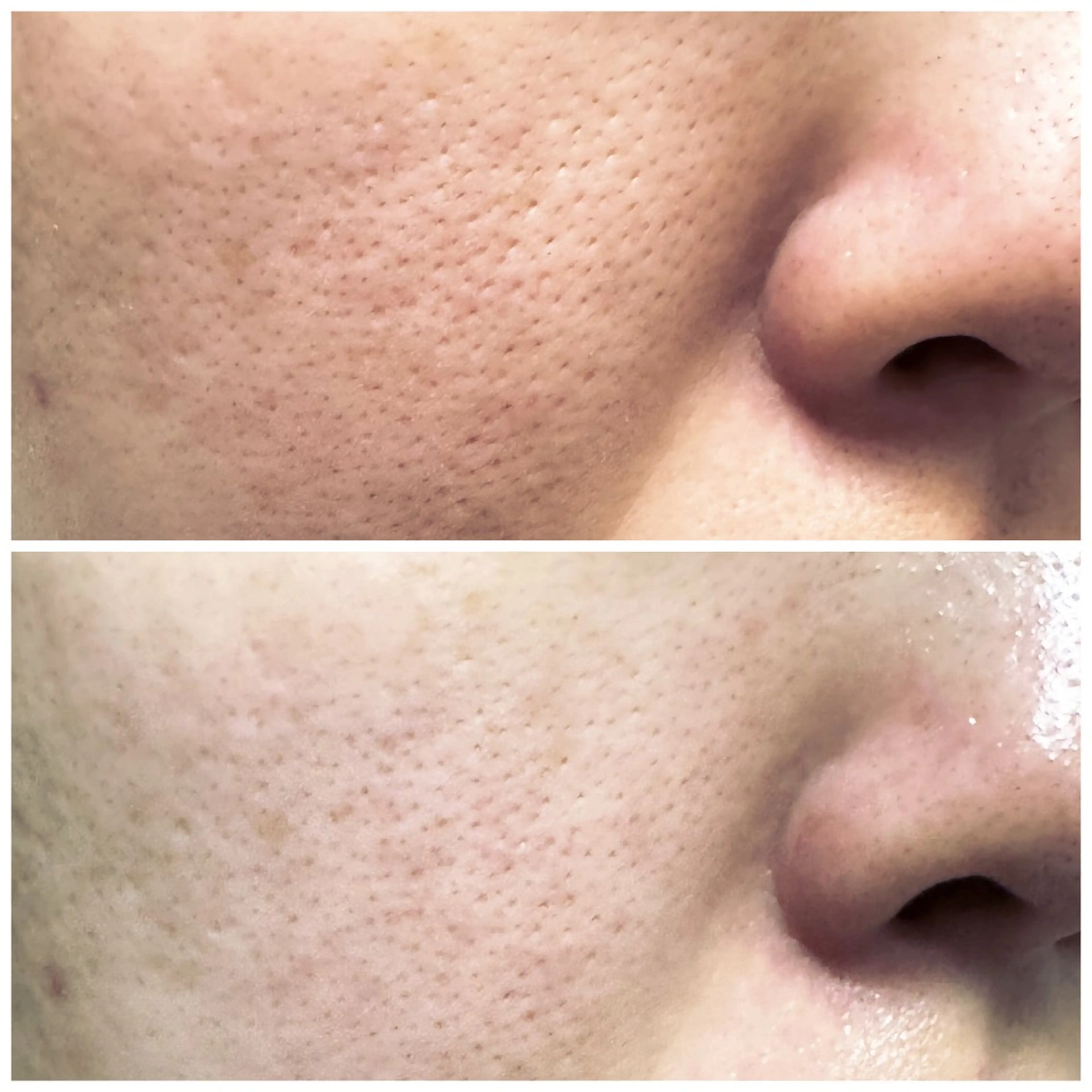 サロンur（ユア） Rieのエステ・リラクイメージ