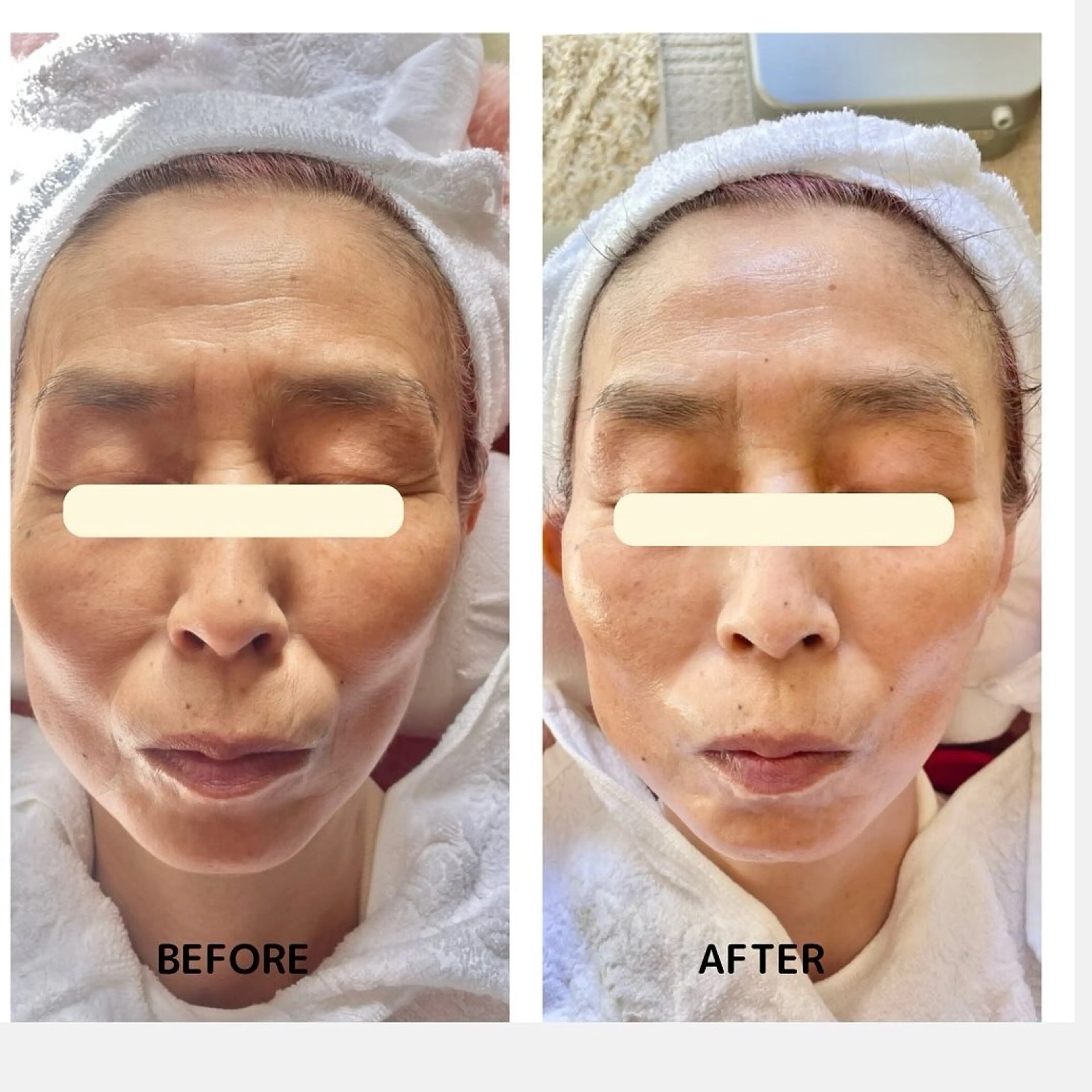 Yoshino Erinaのエステ・リラクイメージ