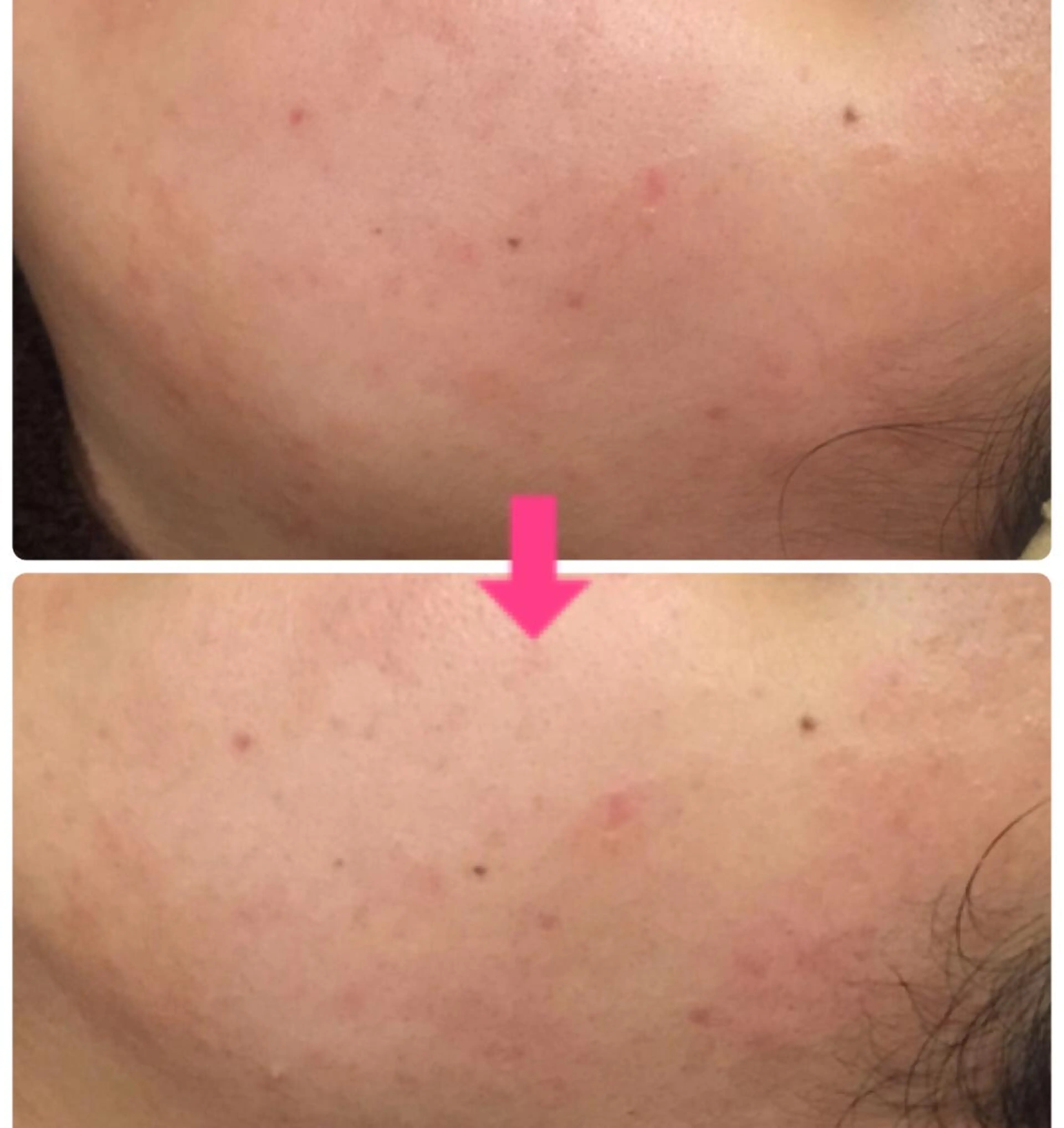 ロング カラー パーマ ヘアアレンジ メンズ キッズ ネイル マツエク・マツパ ‍痩身＆ボディ 結果出し🌟丹野のエステ・リラクイメージ