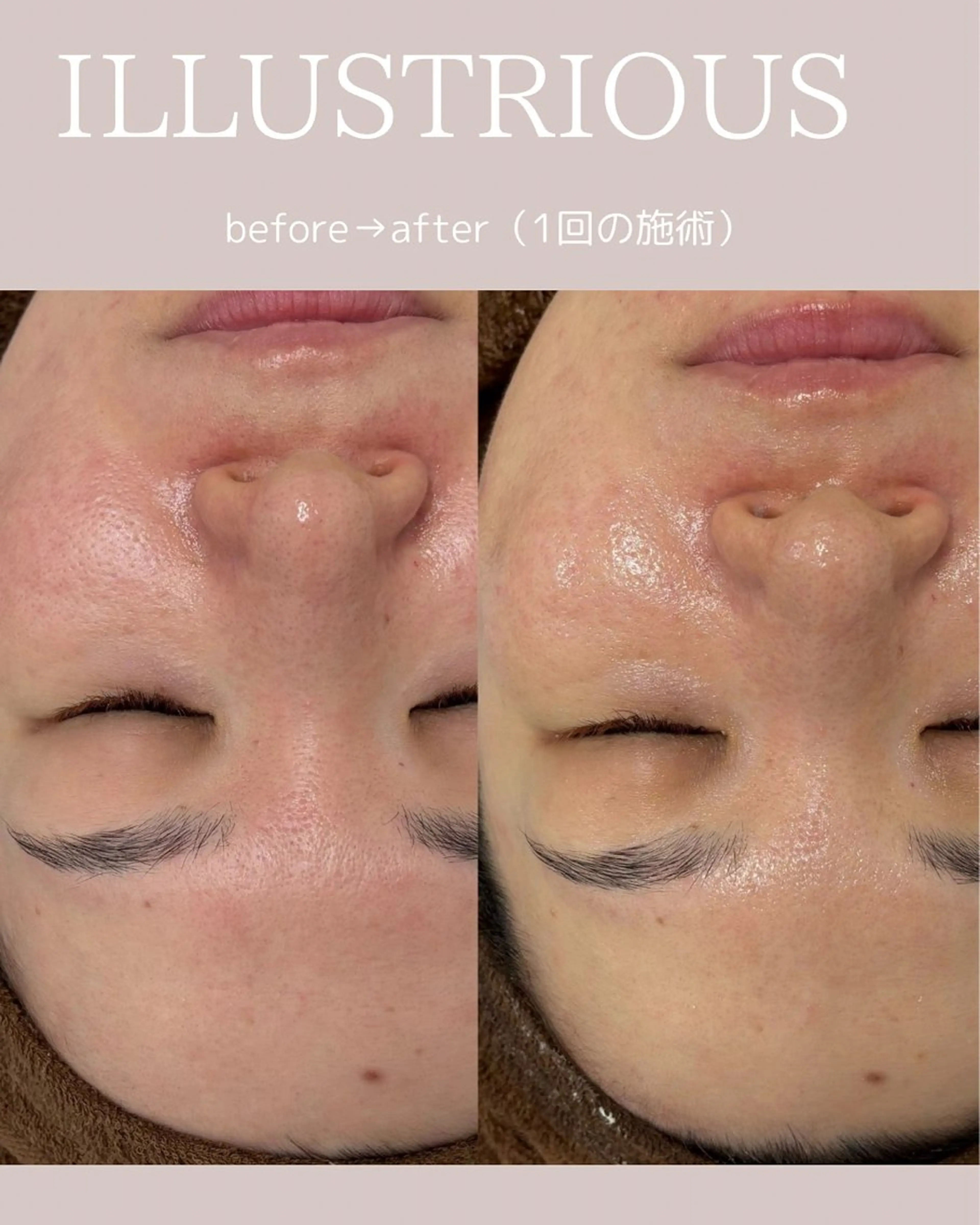 松尾 佳奈のエステ・リラクイメージ