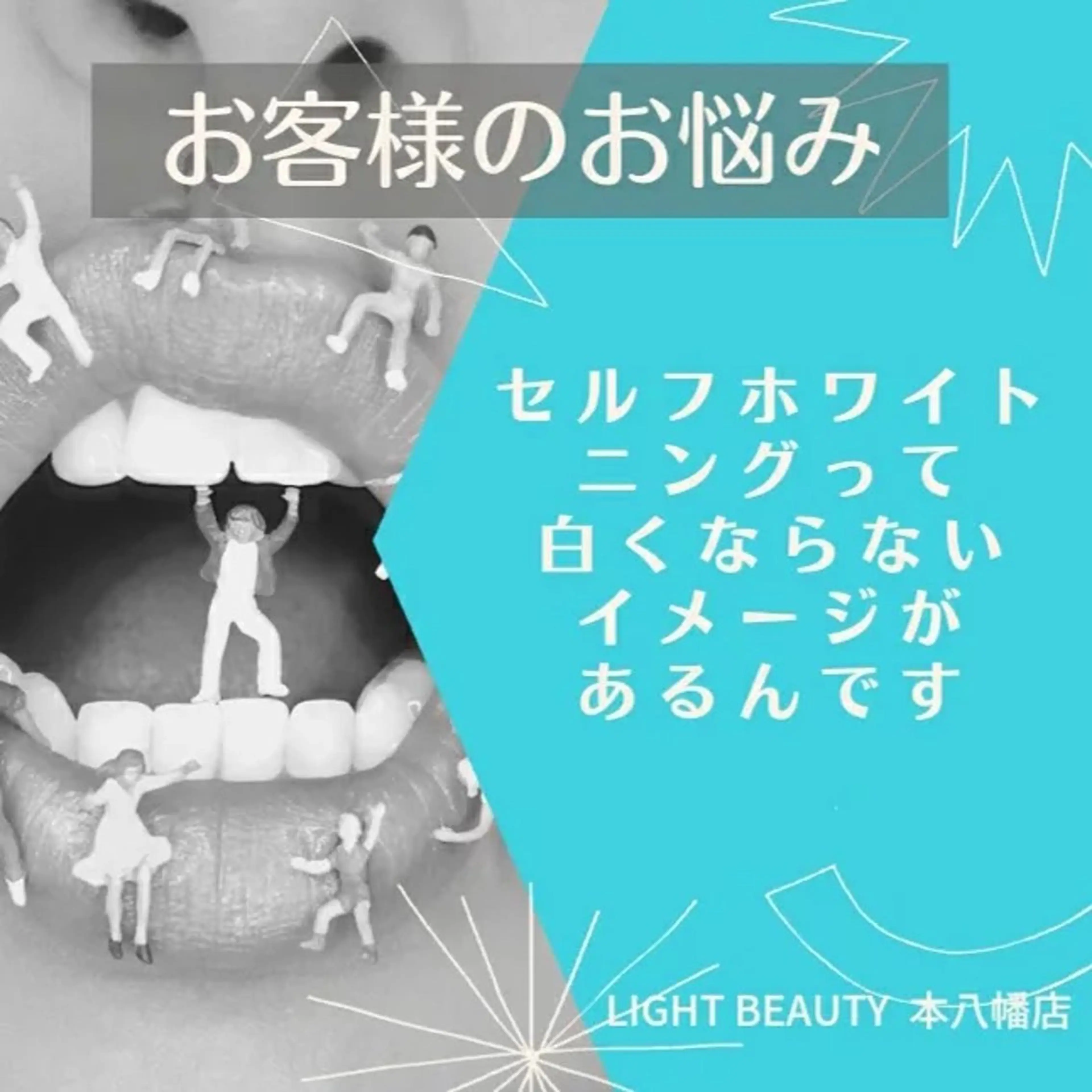 【ホワイトニング乗換割】他セルフホワイトニングサロン、歯科医で満足できなかった方💝チケットも割引あり！初回2,280円の写真