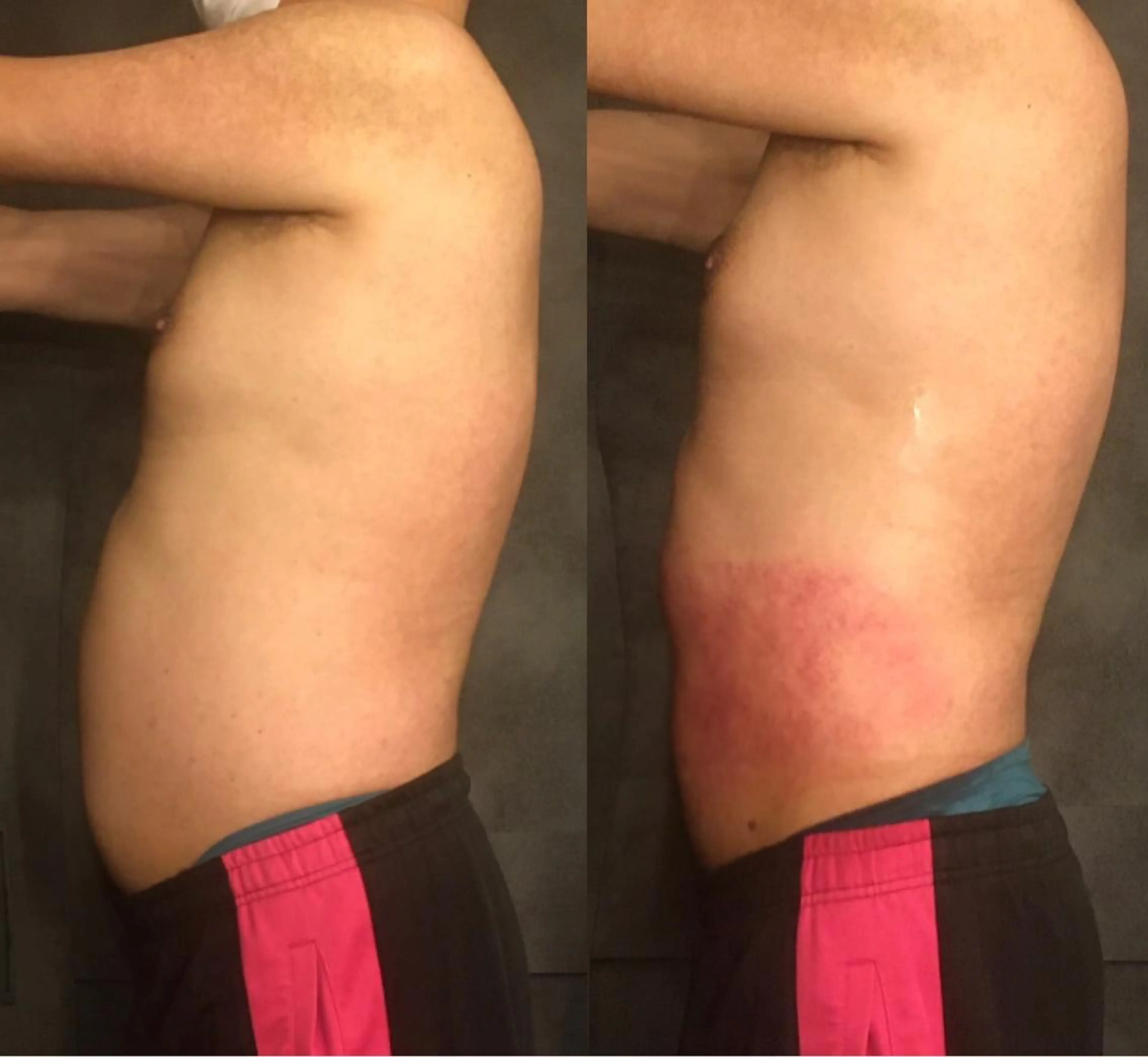 小顔やたるみに特化 💚野瀬可蓮のその他イメージ