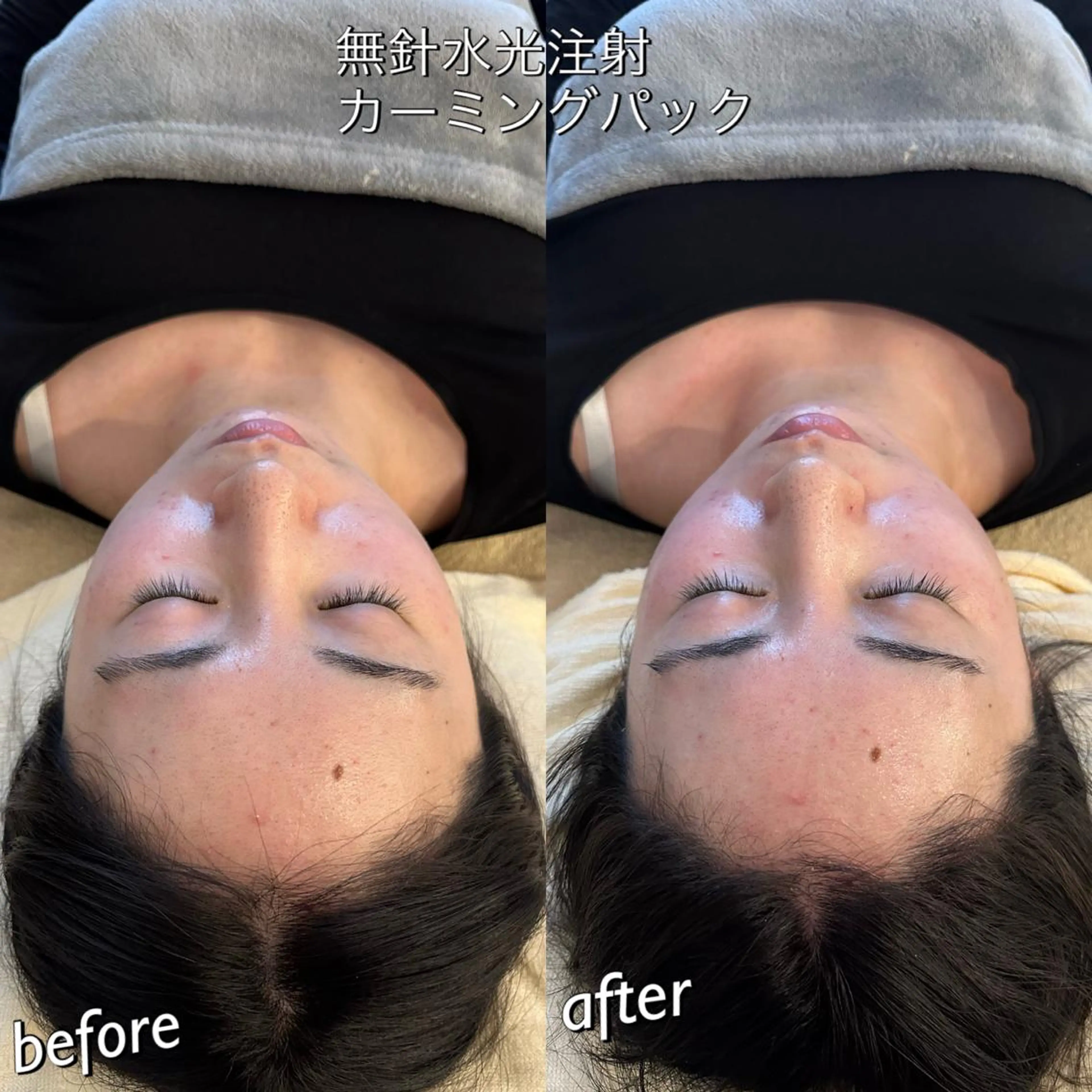 うなじ脱毛/美肌脱毛 LABELのエステ・リラクイメージ