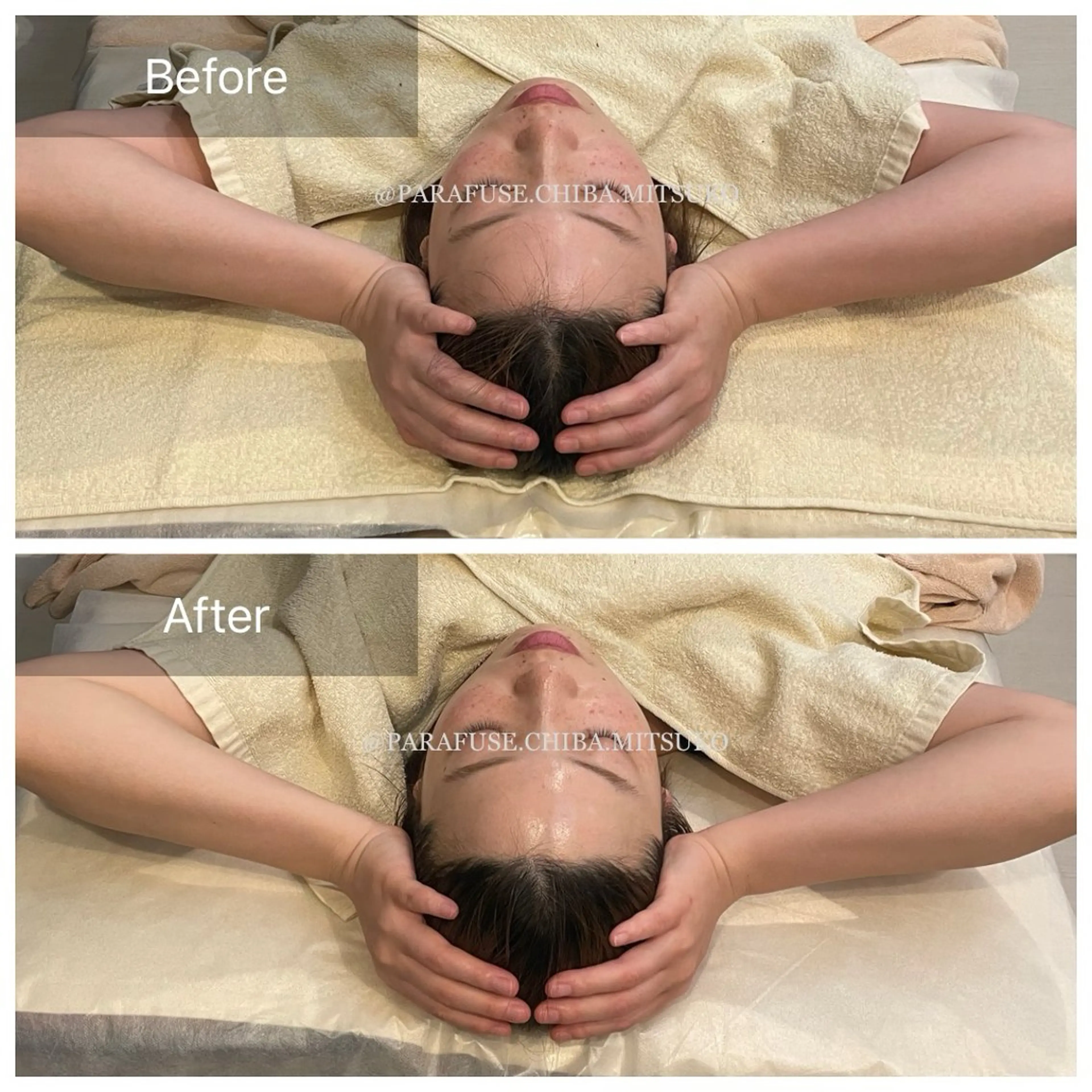 【脳洗浄®100分フルコース】1番人気！の写真