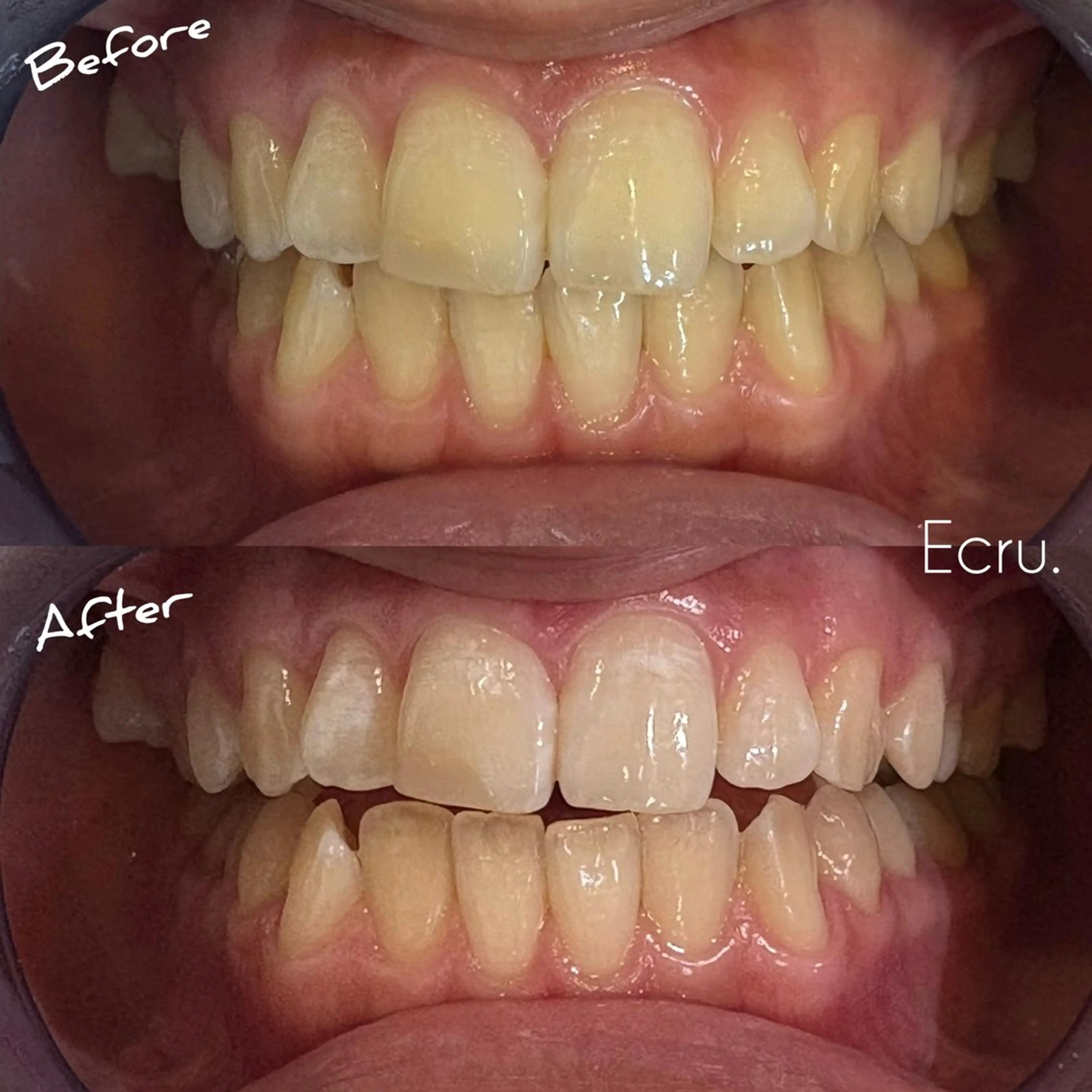 メンズ キッズ エステ ホワイトニングサロン Ecru エクリュのその他イメージ
