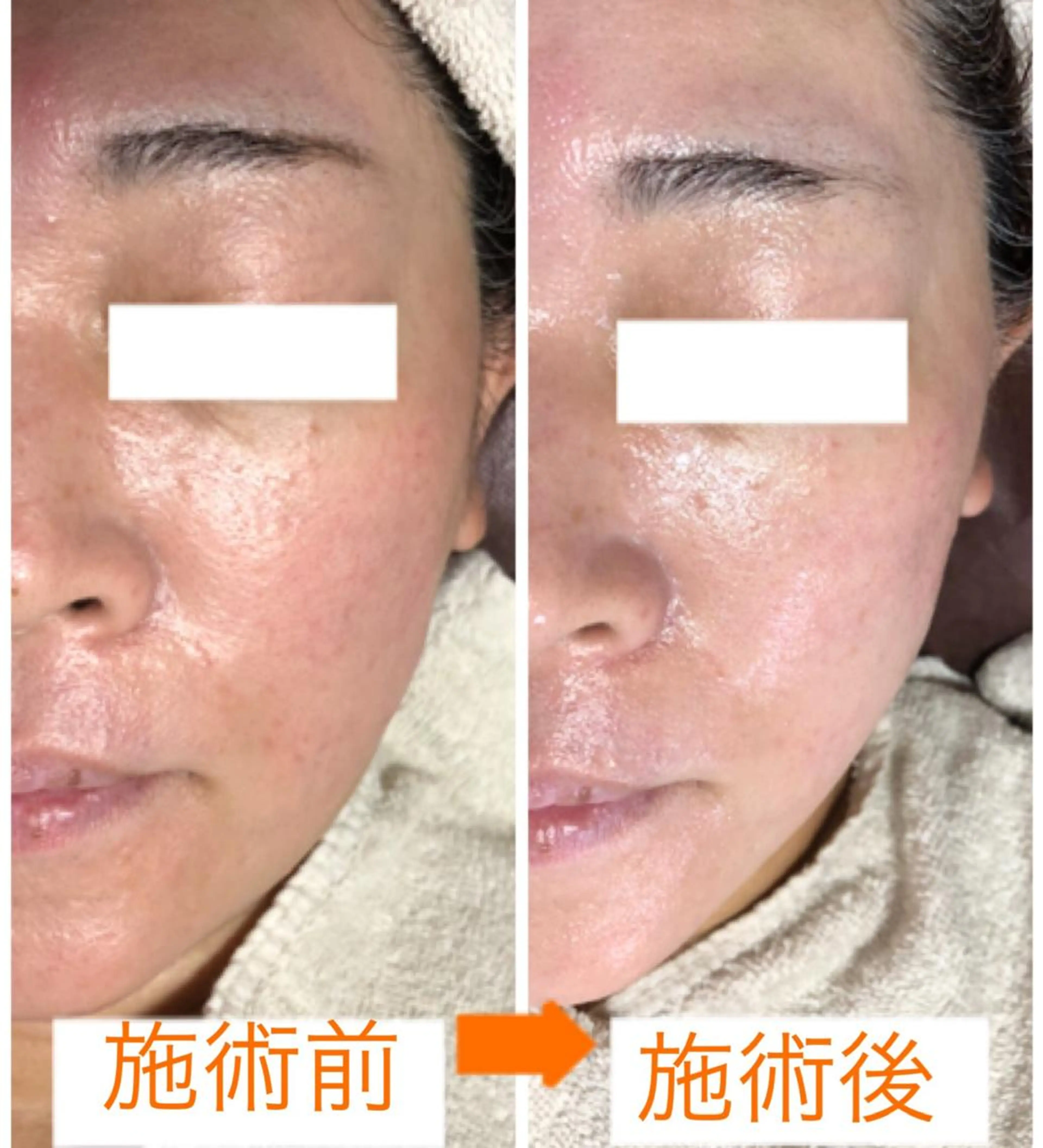 エステ リラク 小顔・毛穴・たるみ ネイル　似内真樹のエステ・リラクイメージ