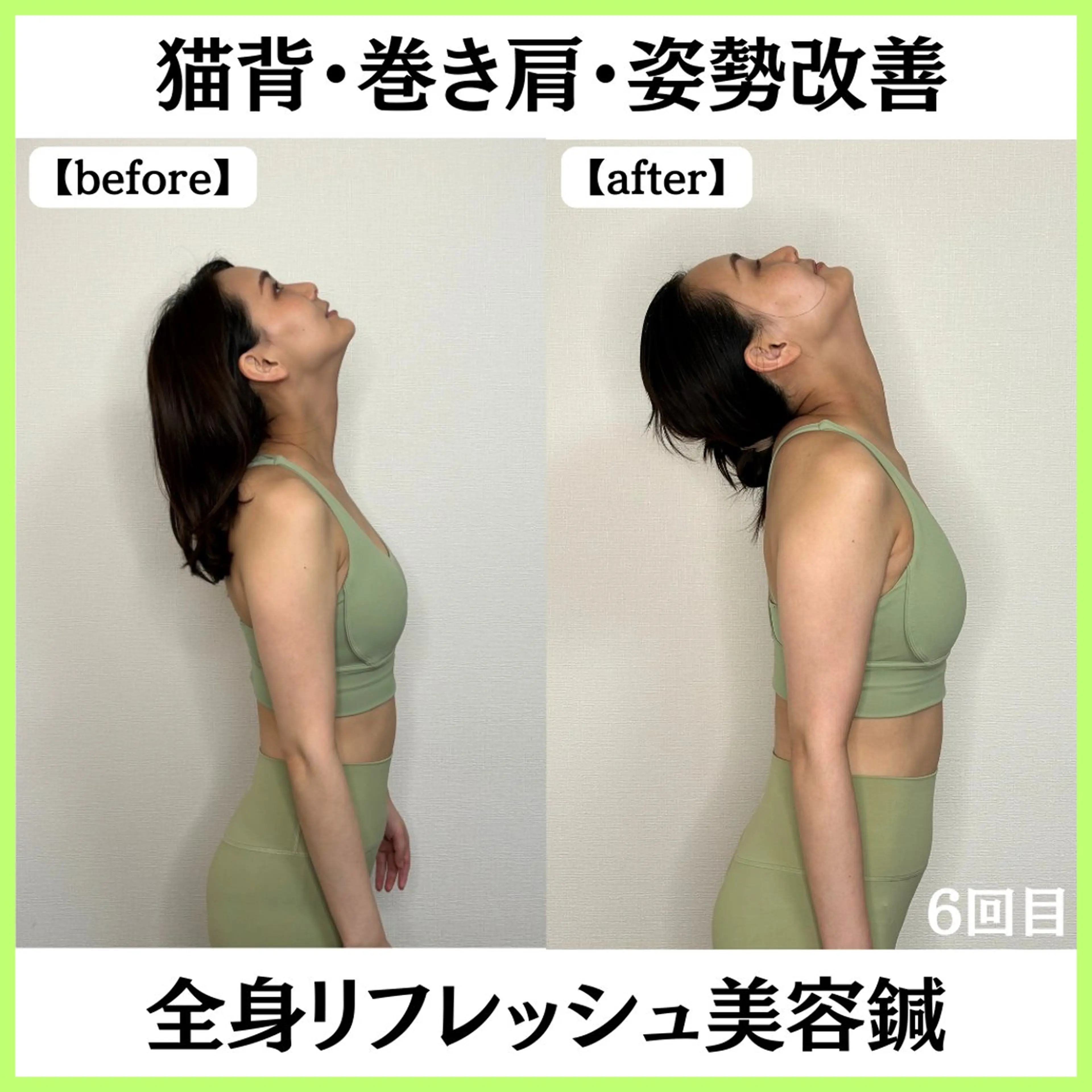 小顔ハーブピーリング 美容鍼/毛穴洗浄のエステ・リラクイメージ